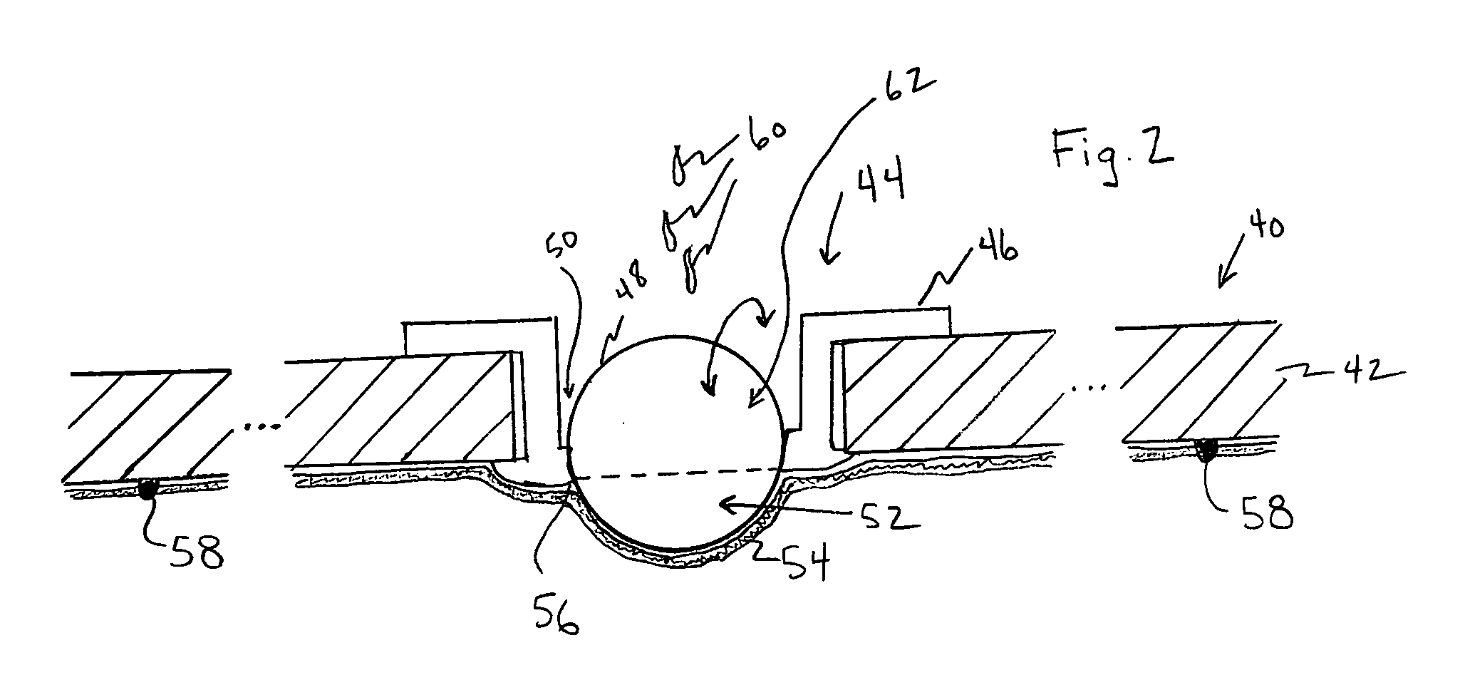 Pearl culture method and product