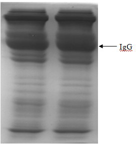 Method for purifying human immunoglobulin from separated component I+III of blood plasma