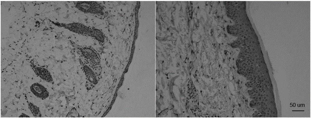 Application of PPARdelta (Peroxisome proliferator-activated receptor delta) selective antagonist in preparation of drugs for treating psoriasis