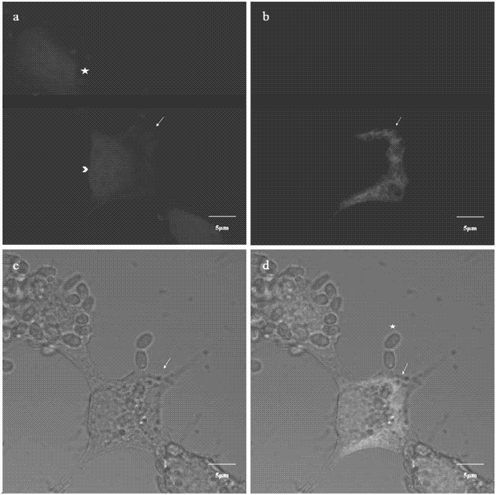 Nucleic acid probe of specific marker nosema bombycis and in-vivo fluorescence hybridization detection method of nucleic acid probe