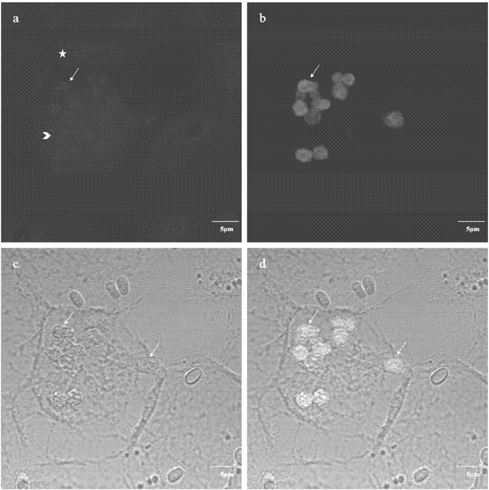 Nucleic acid probe of specific marker nosema bombycis and in-vivo fluorescence hybridization detection method of nucleic acid probe