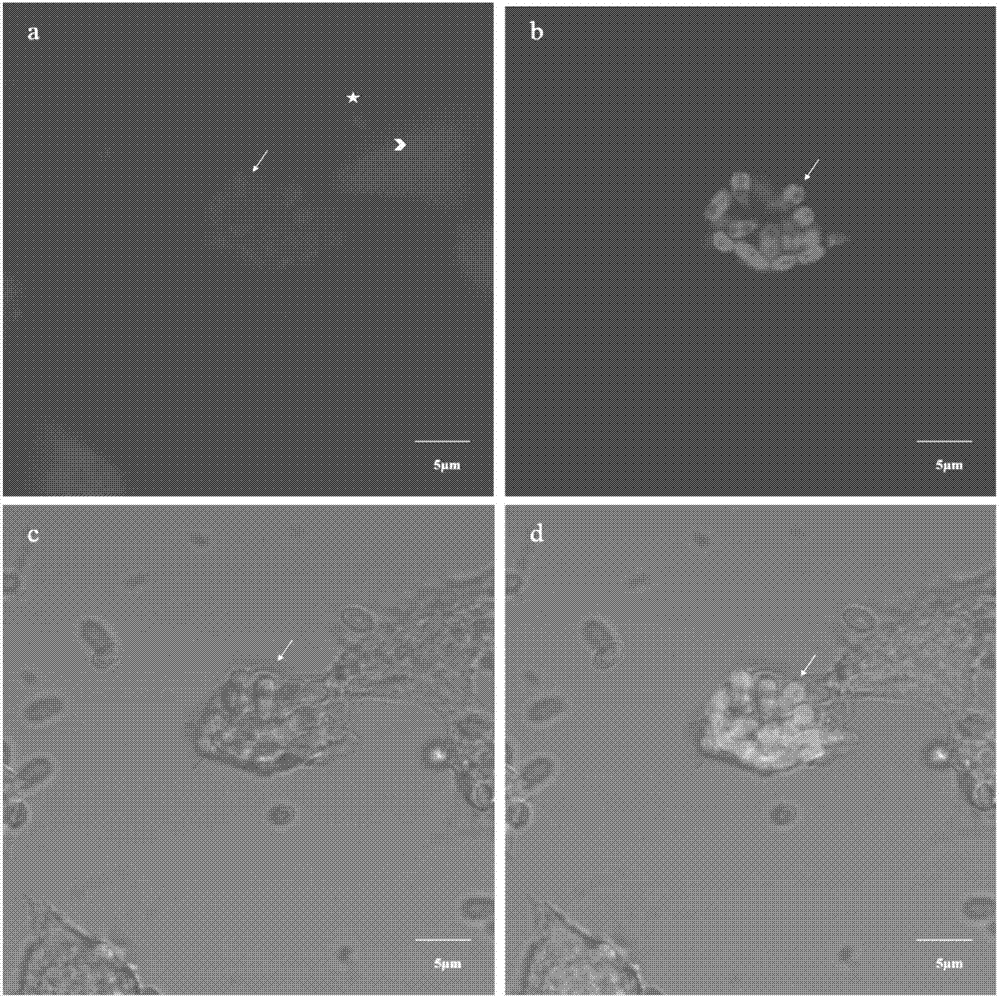 Nucleic acid probe of specific marker nosema bombycis and in-vivo fluorescence hybridization detection method of nucleic acid probe