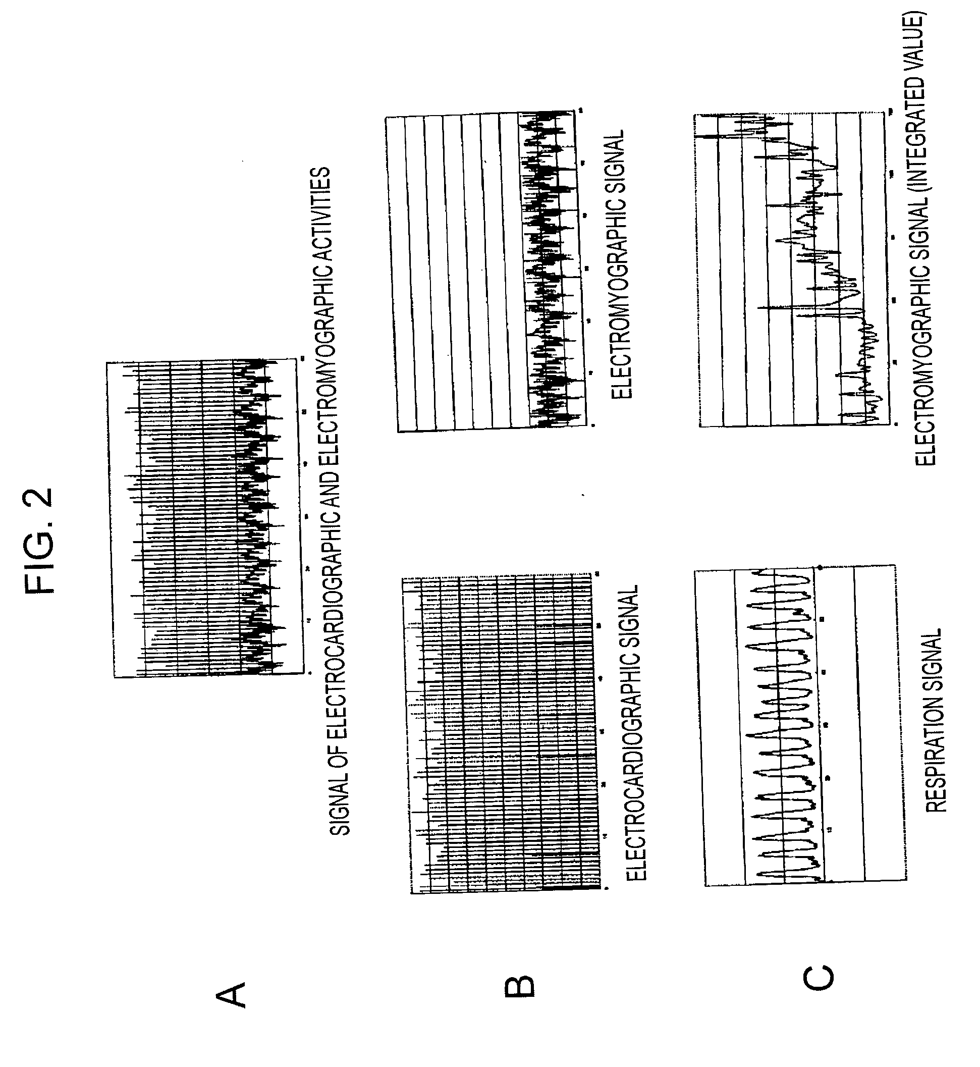 Bio-information processing apparatus and video/sound reproduction apparatus