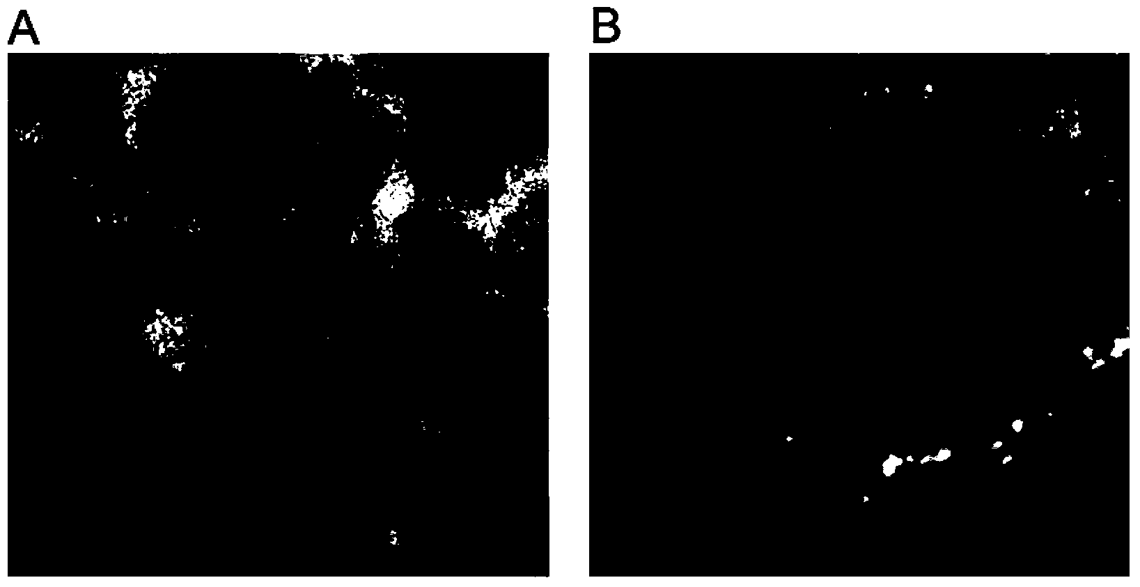 Application of bionic reconstituted high-density lipoprotein in preparation of drugs for prevention and treatment of Alzheimer disease