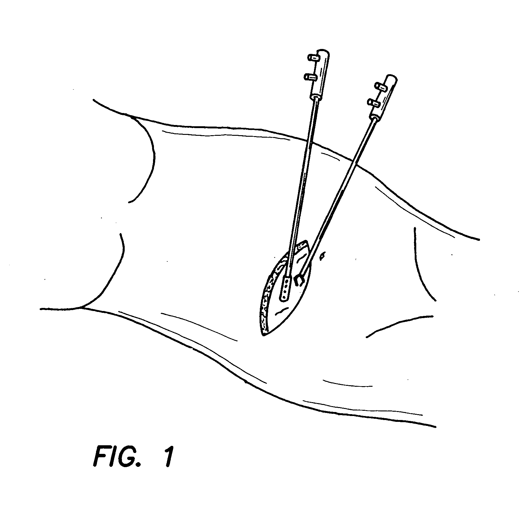 Multiple function surgical device