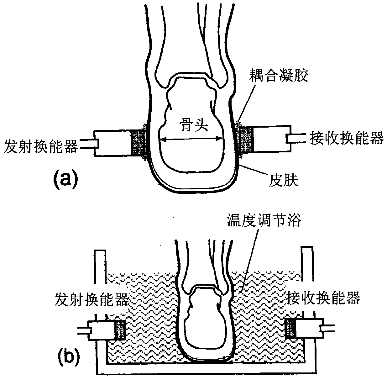 Bone detection method and device and bone densitometer