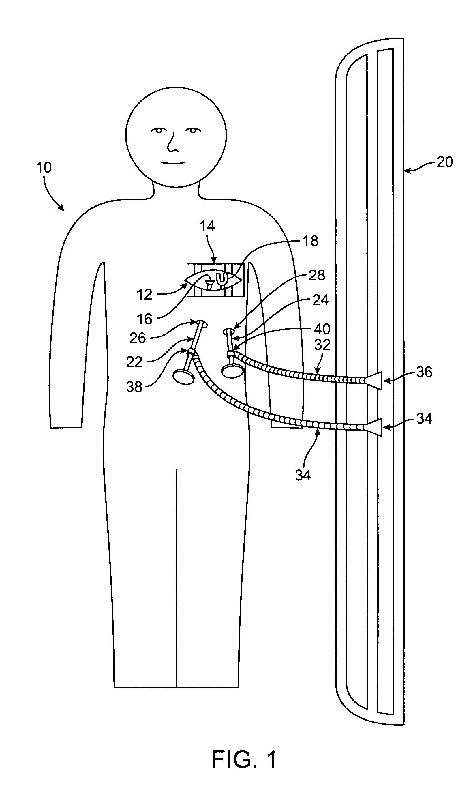 Methods and devices for cardiac surgery