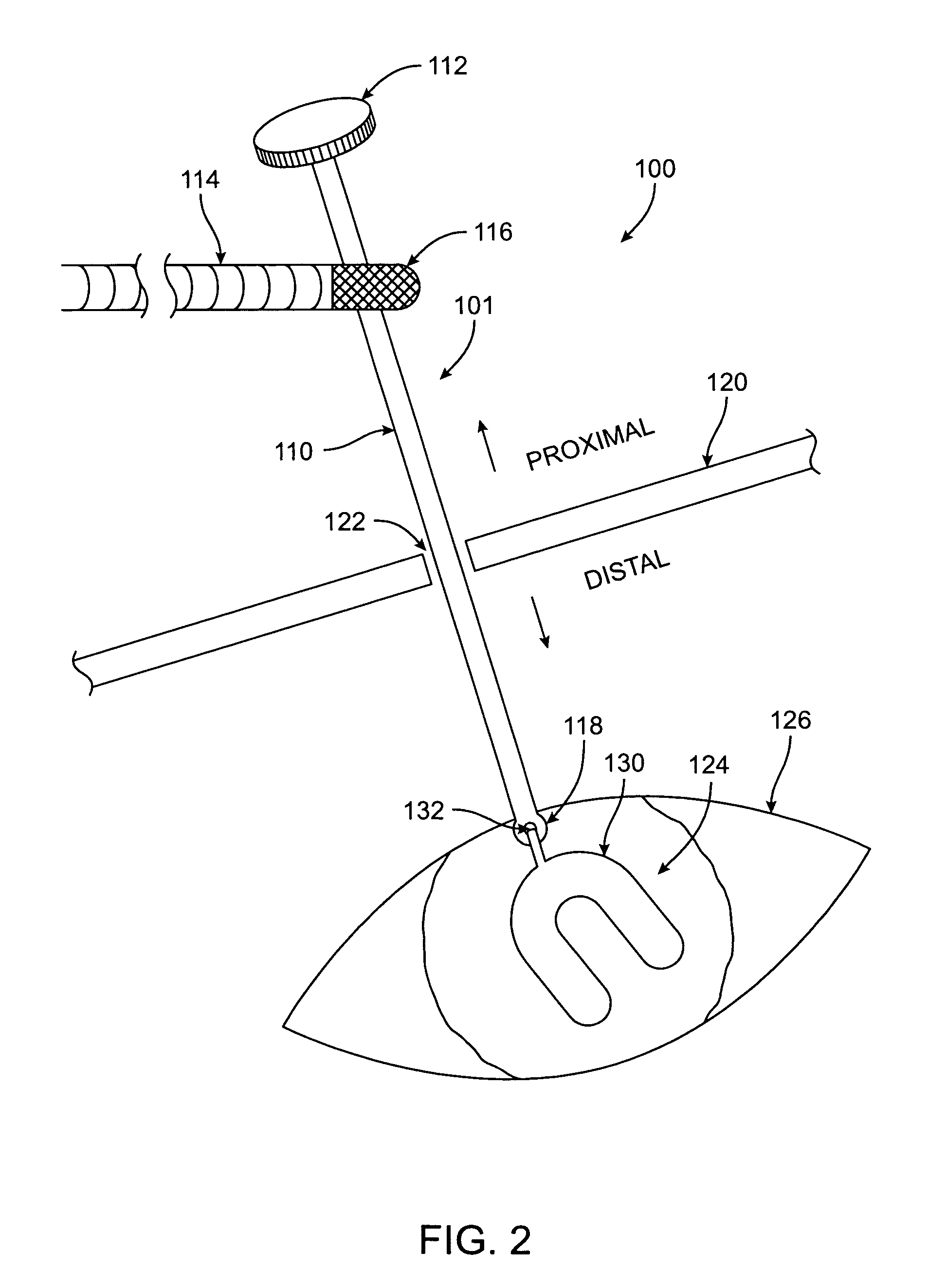 Methods and devices for cardiac surgery