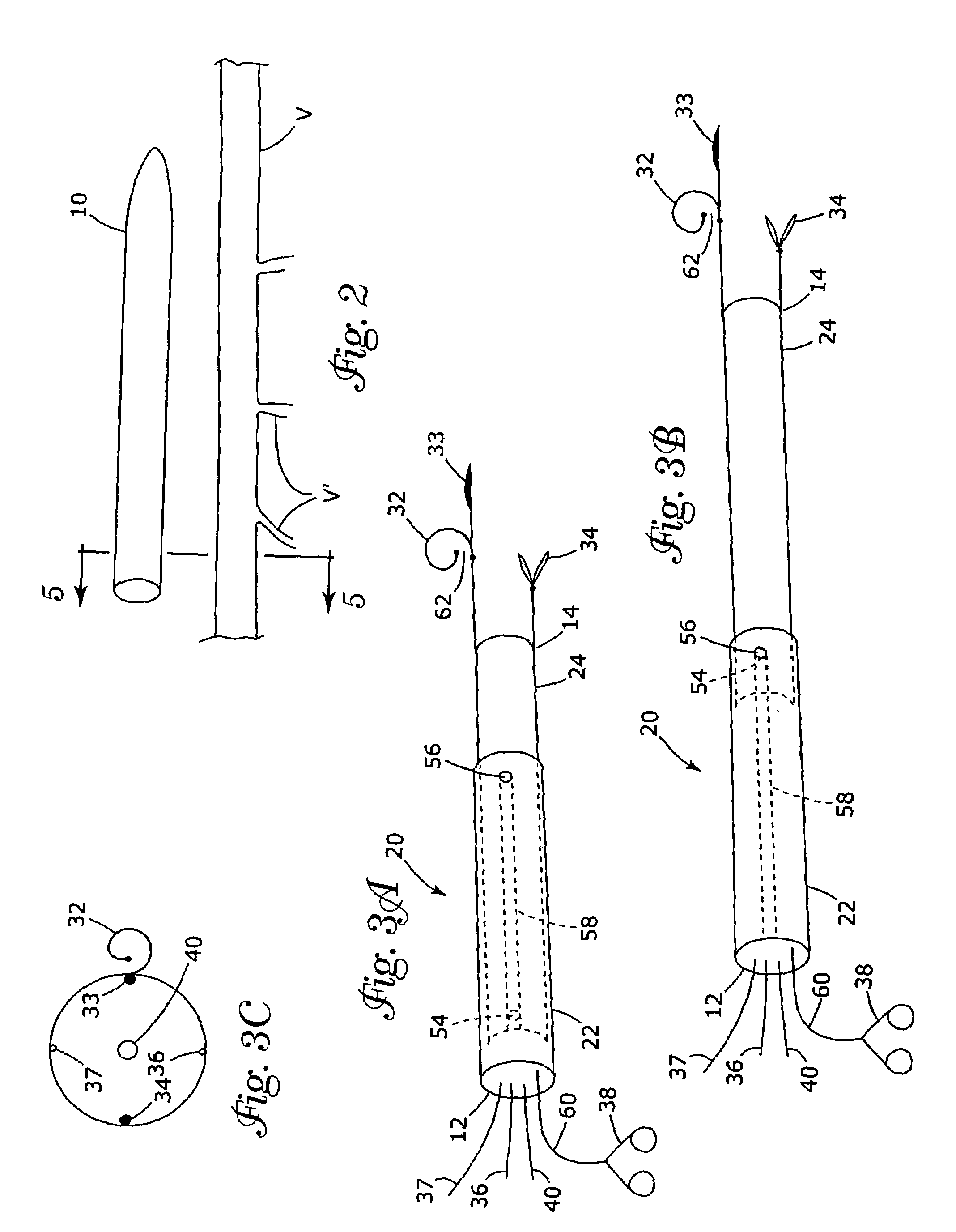 Vein harvesting system and method