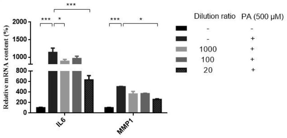 A drug for improving aortic endothelial cell function and its application