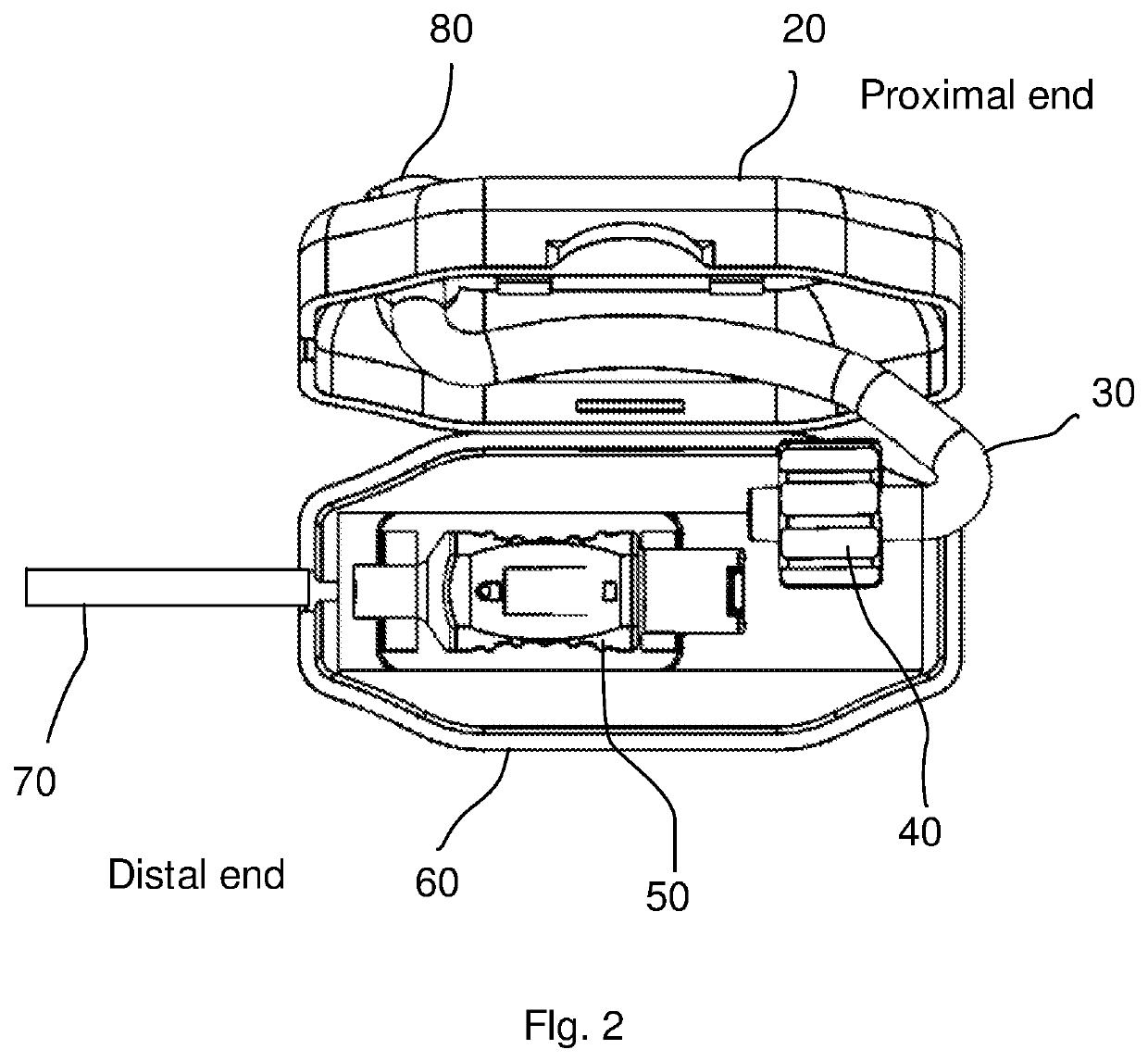 Catheter decoupling device