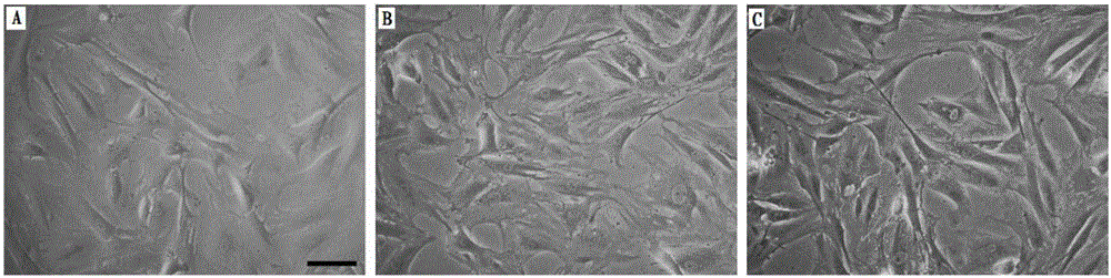 Preparation method and application of human umbilical cord mesenchymal stem cells