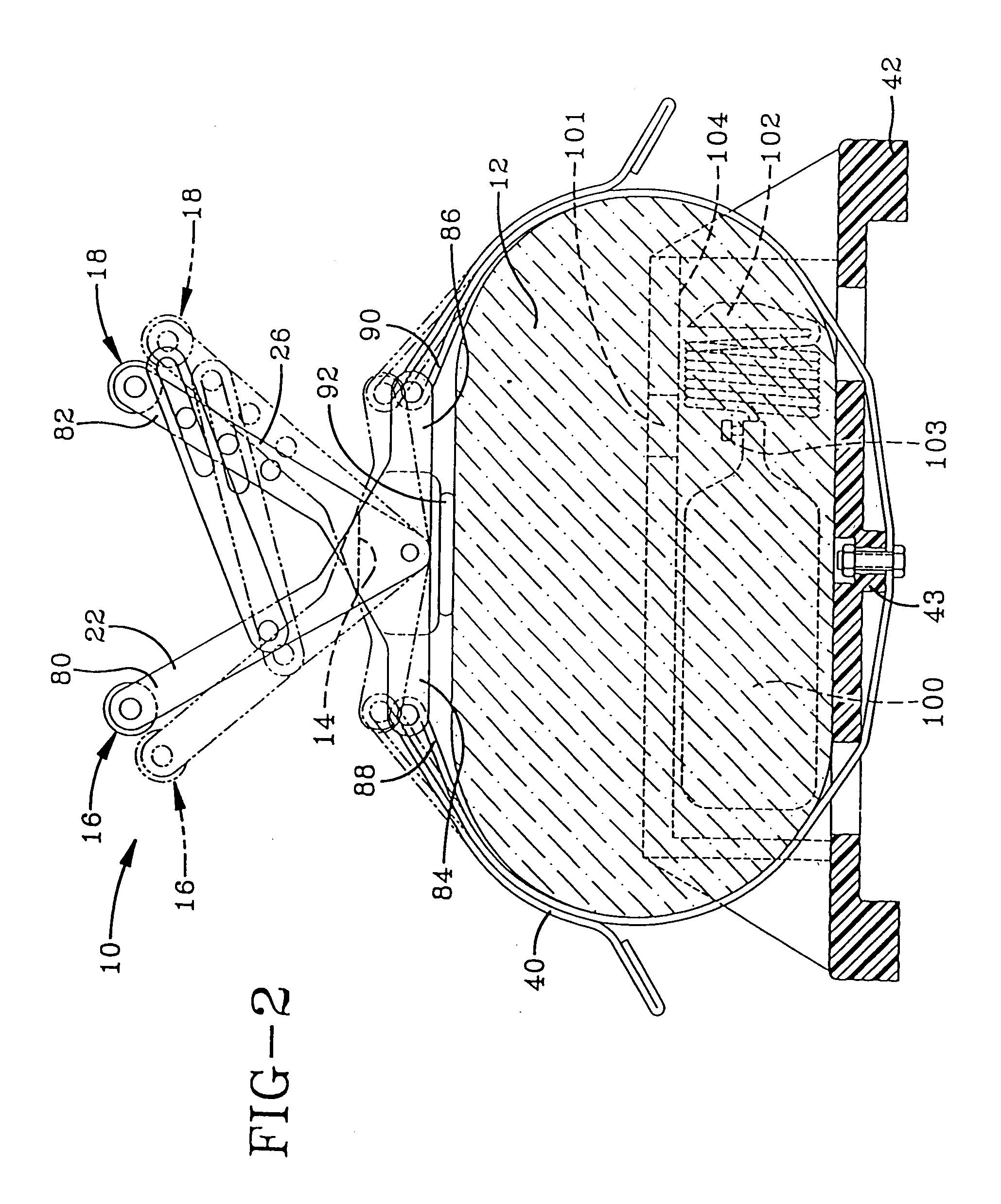 Chest compression apparatus for cardiac arrest