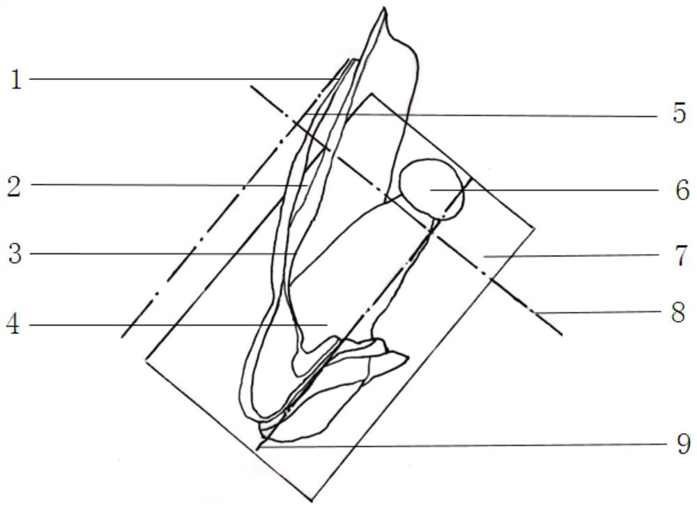 A digital design and manufacture method of apical surgical guide