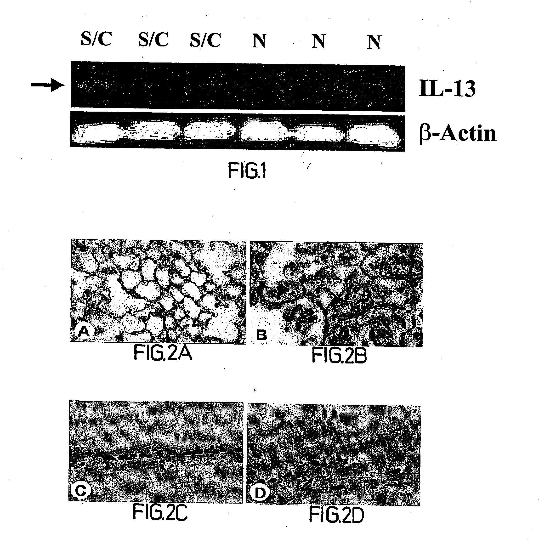 Methods, compositions and kits relating to chitinases and chitinase-like molecules and inflammatory disease