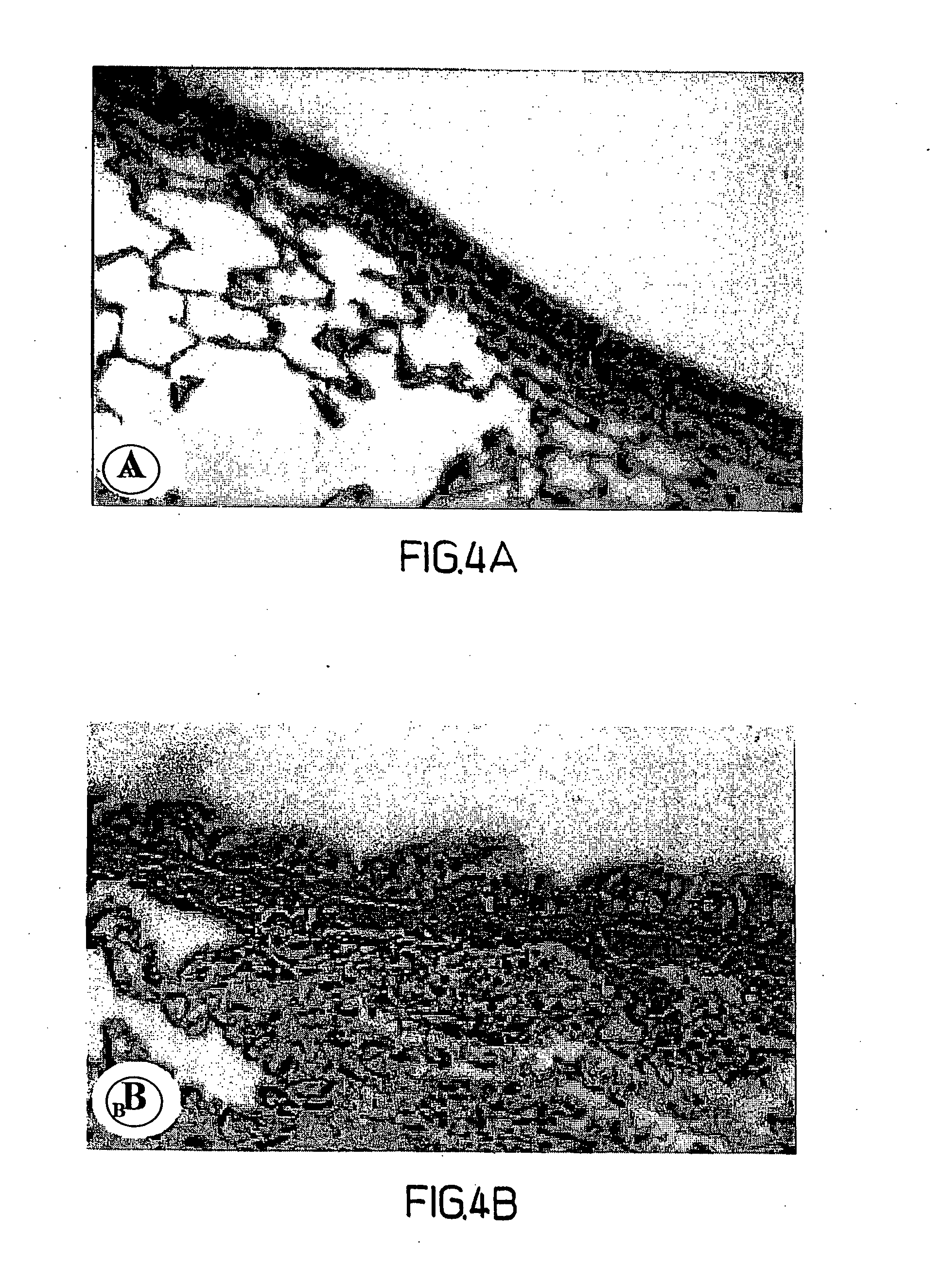 Methods, compositions and kits relating to chitinases and chitinase-like molecules and inflammatory disease