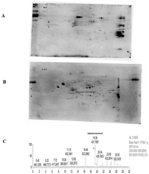 Detection kit for anti-peptidyl prolyl cis-trans isomerase D-IgG antibody