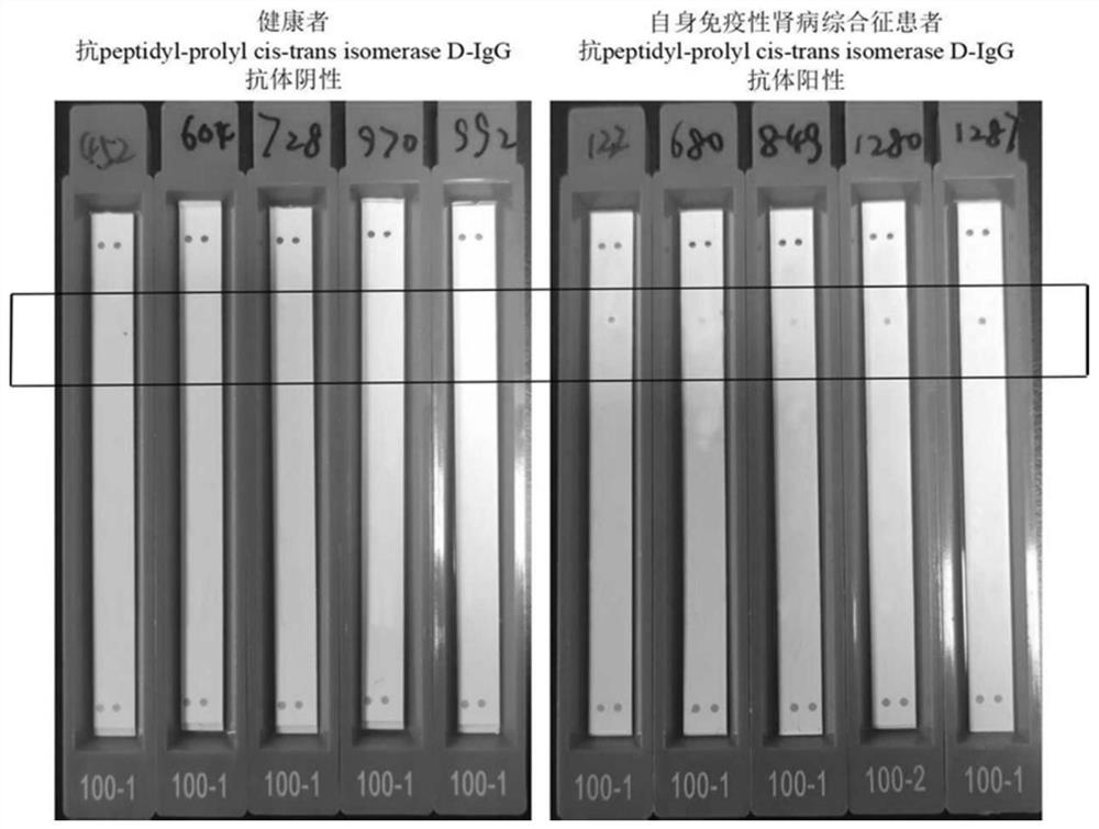 Detection kit for anti-peptidyl prolyl cis-trans isomerase D-IgG antibody