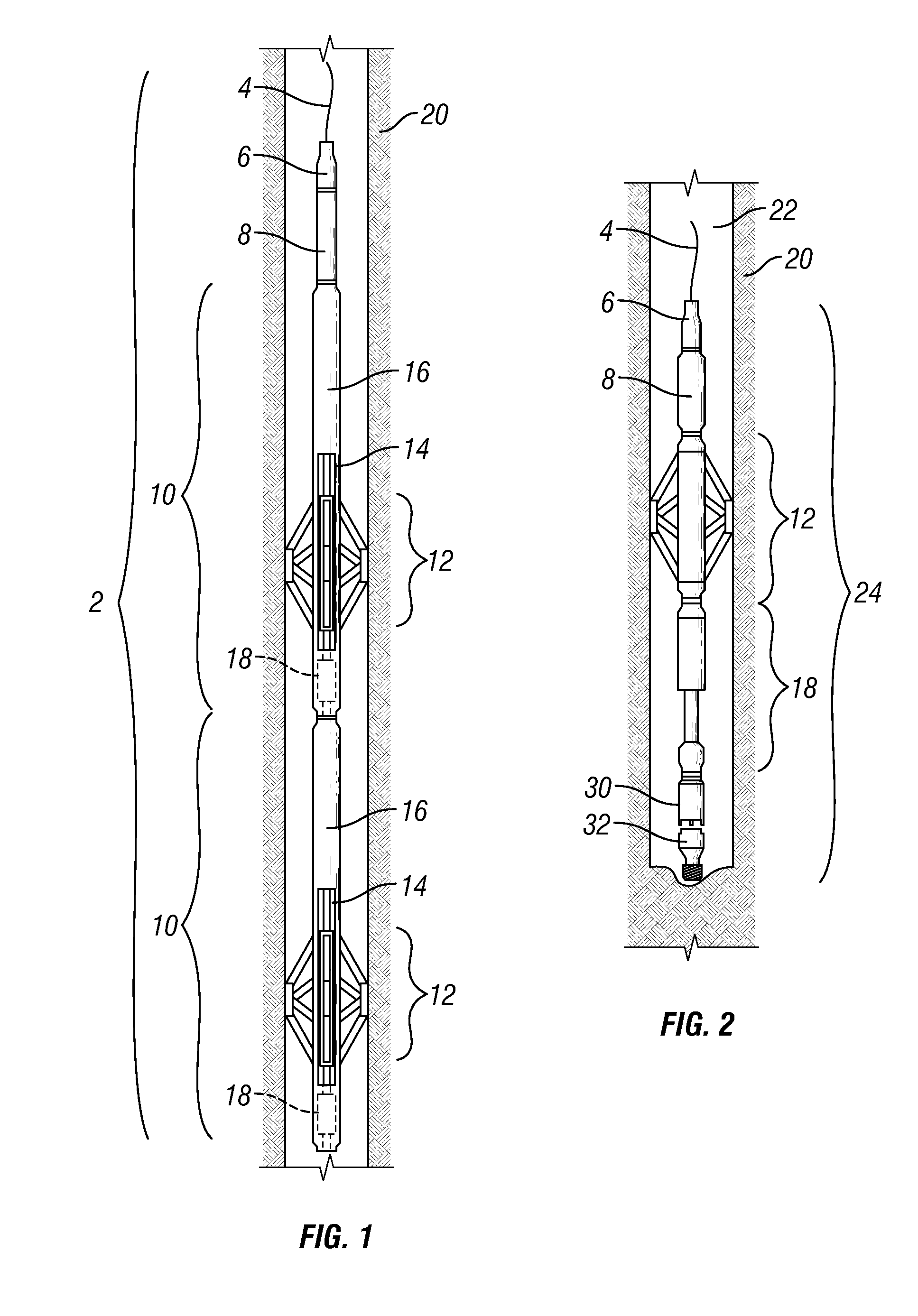 Self-anchoring device with force amplification