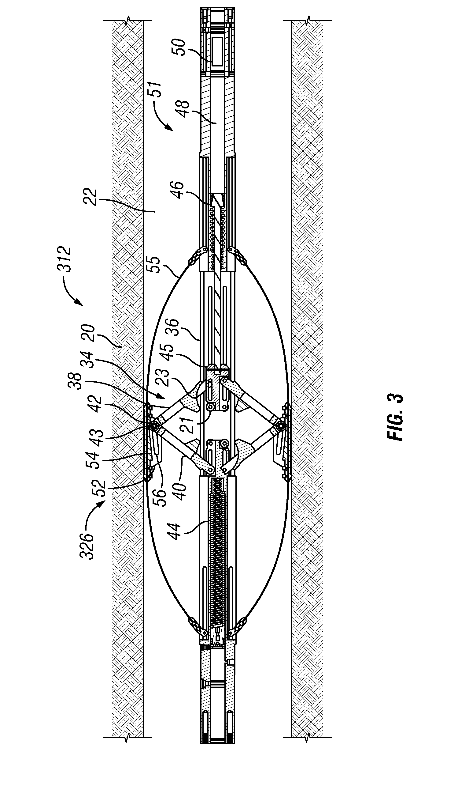 Self-anchoring device with force amplification