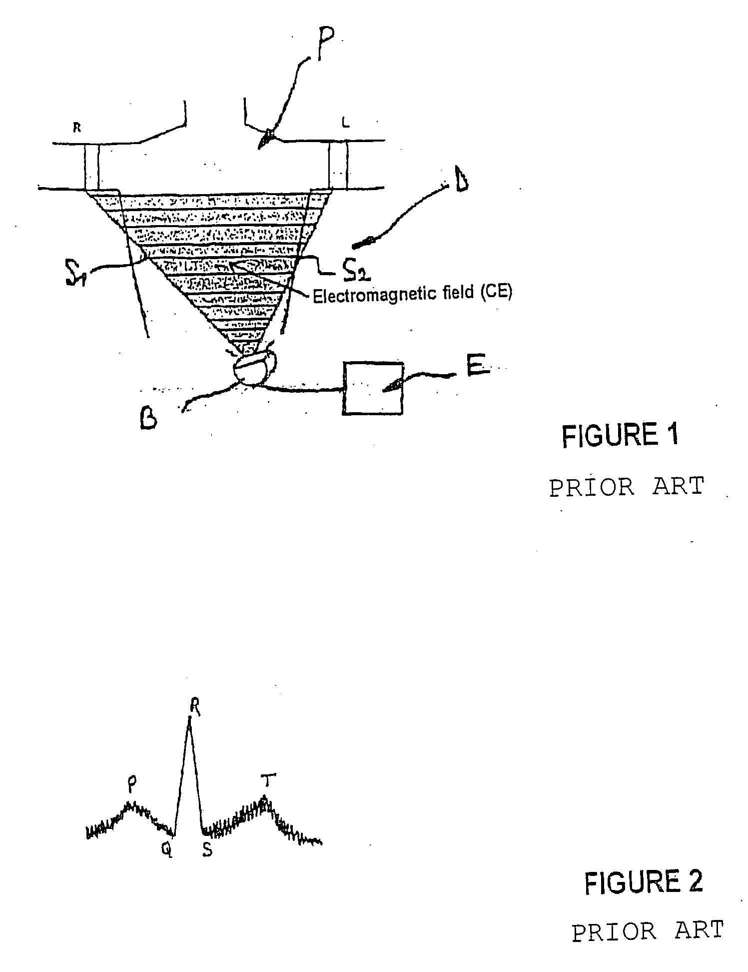 Device for acquiring electric signals coming from the human body and more particularly from the heart