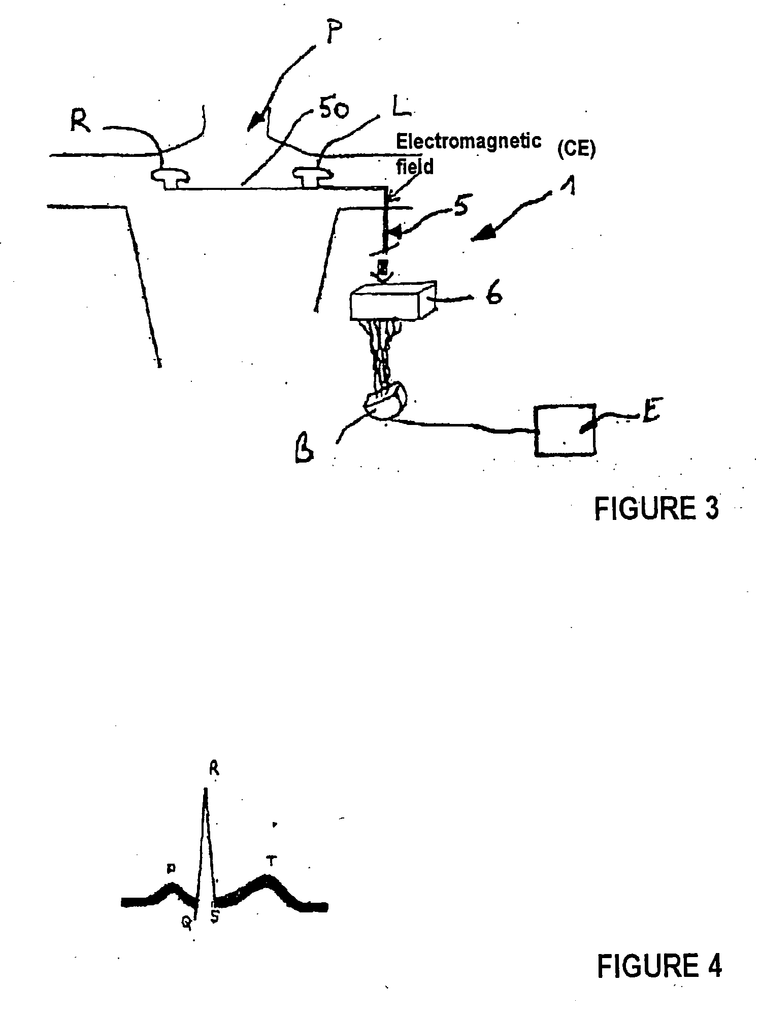 Device for acquiring electric signals coming from the human body and more particularly from the heart