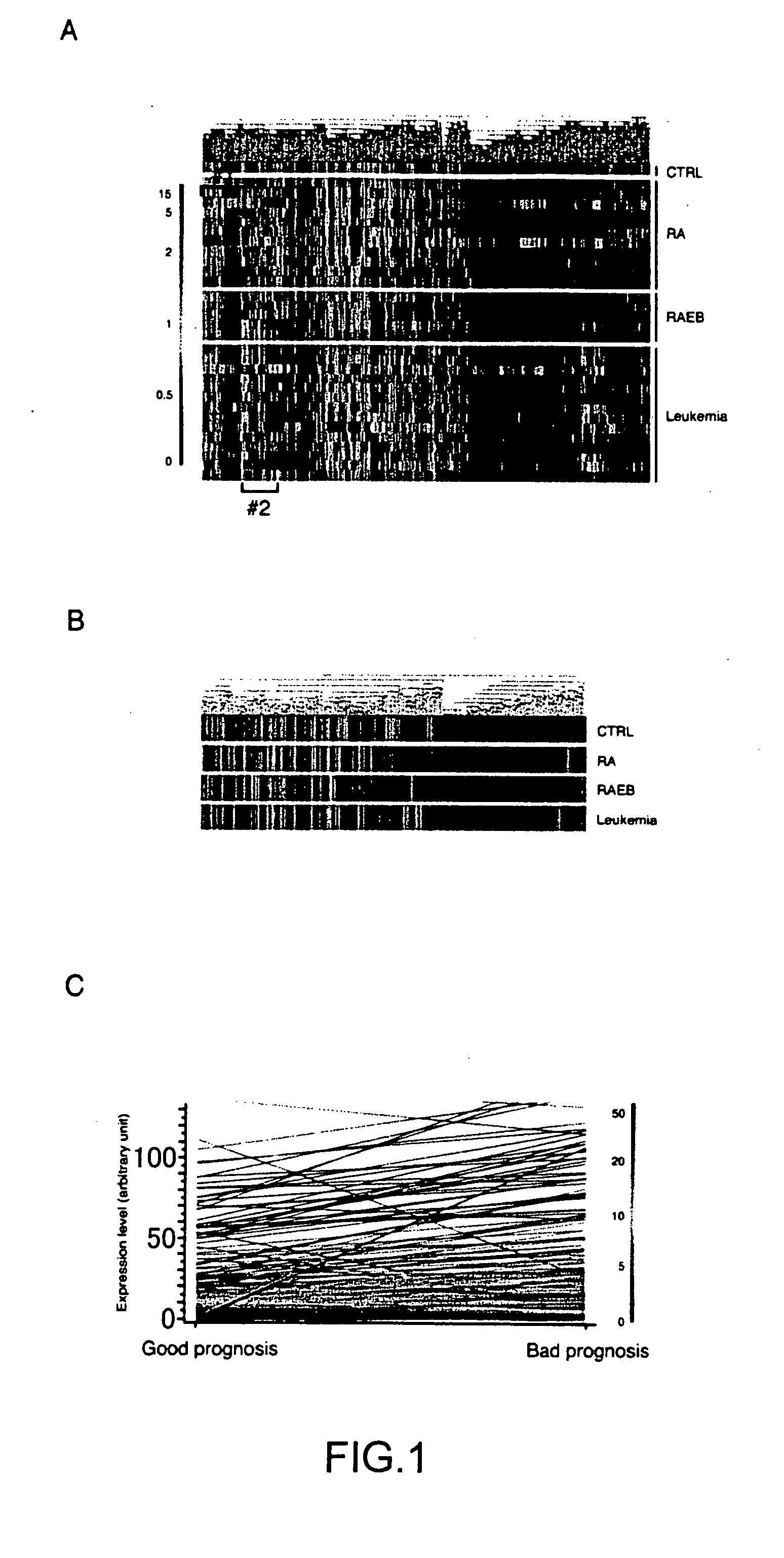 Method for identifying myelodysplastic syndrome-specific genes