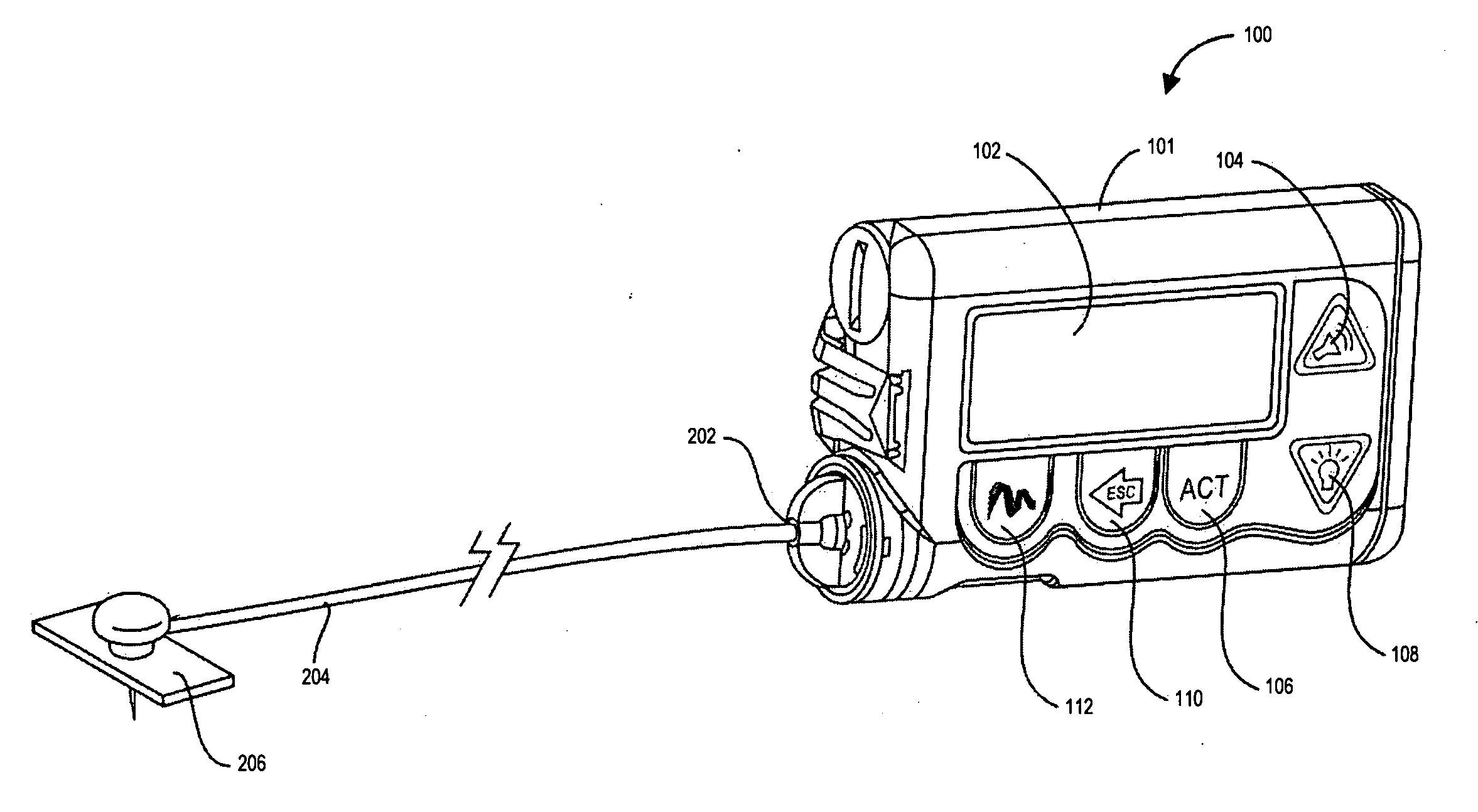 Methods and apparatuses for detecting medical device acceleration, temperature, and humidity conditions