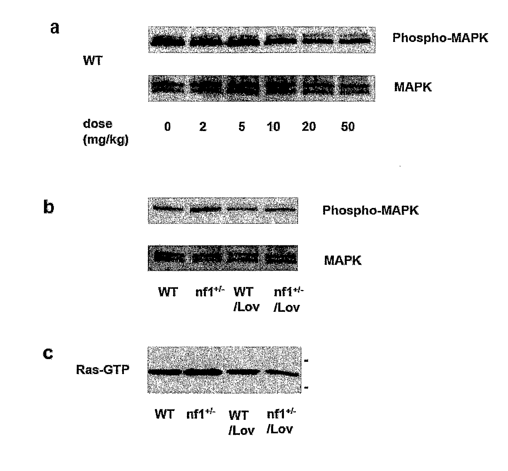 Treating Learning Deficits With Inhibitors of Hmg CoA Reductase