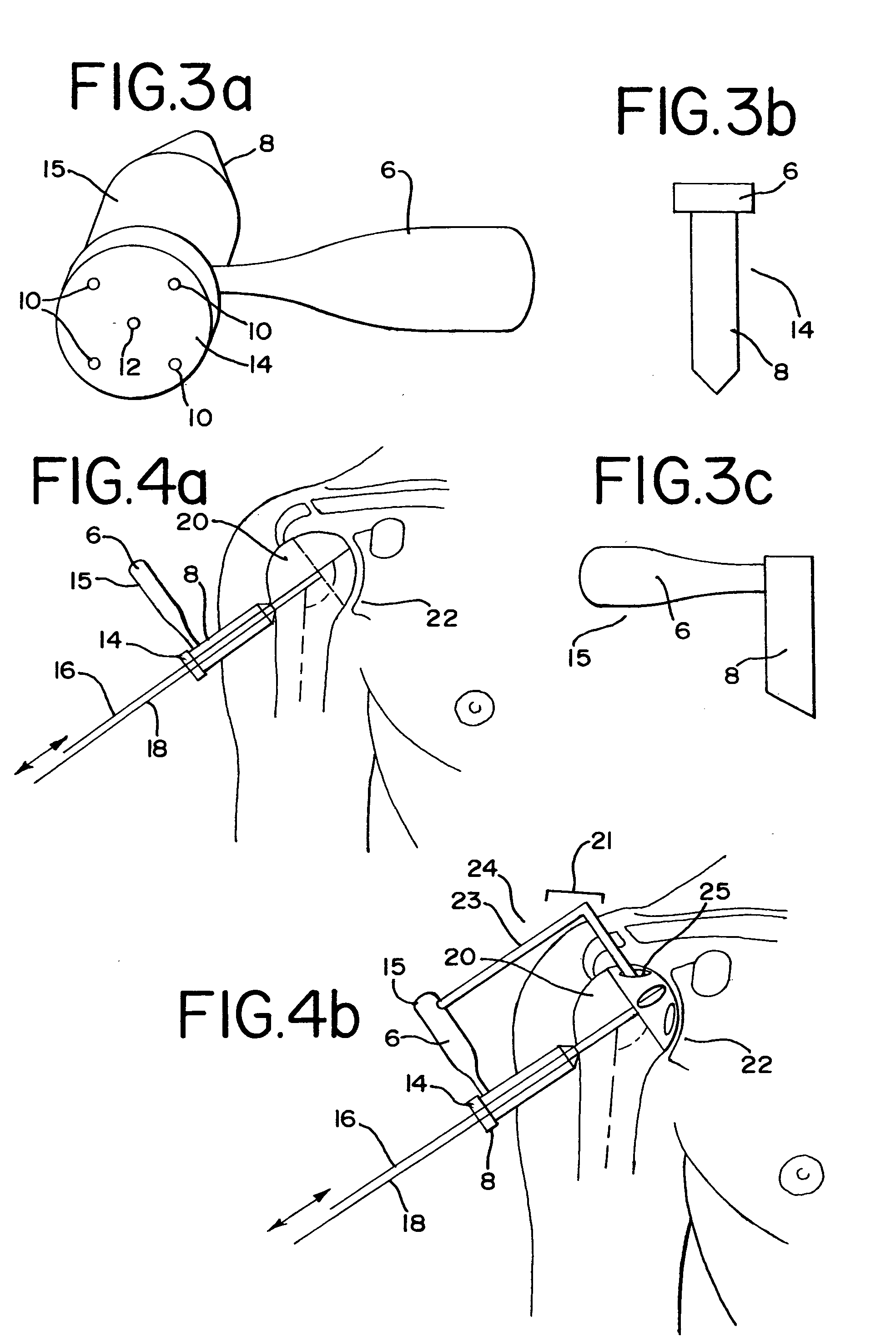 Devices and methods used for shoulder replacement