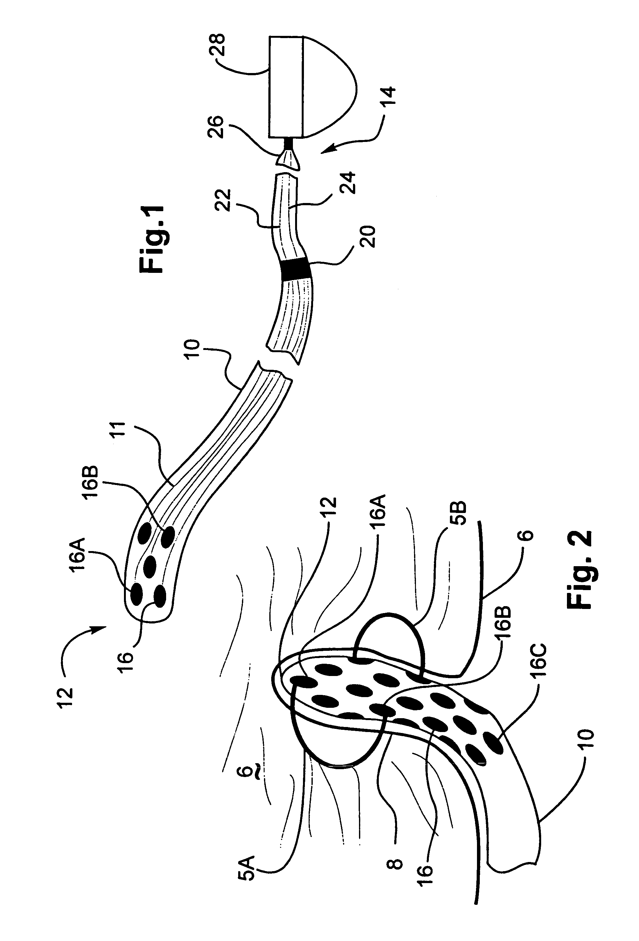 Medical implant device for electrostimulation using discrete micro-electrodes