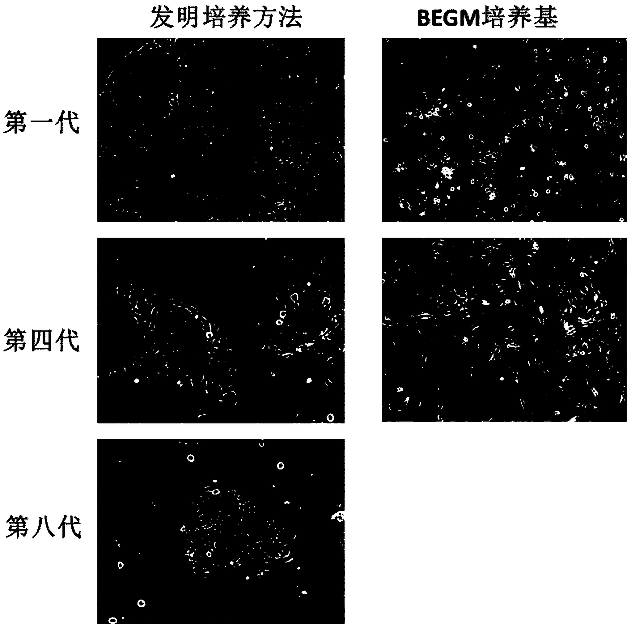 Nose epithelial stem cell culture method and nose epithelial stem cell proliferation medium