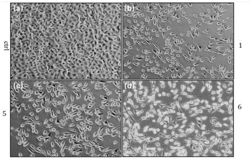 Morus australis root extract as well as extraction separation method and application thereof