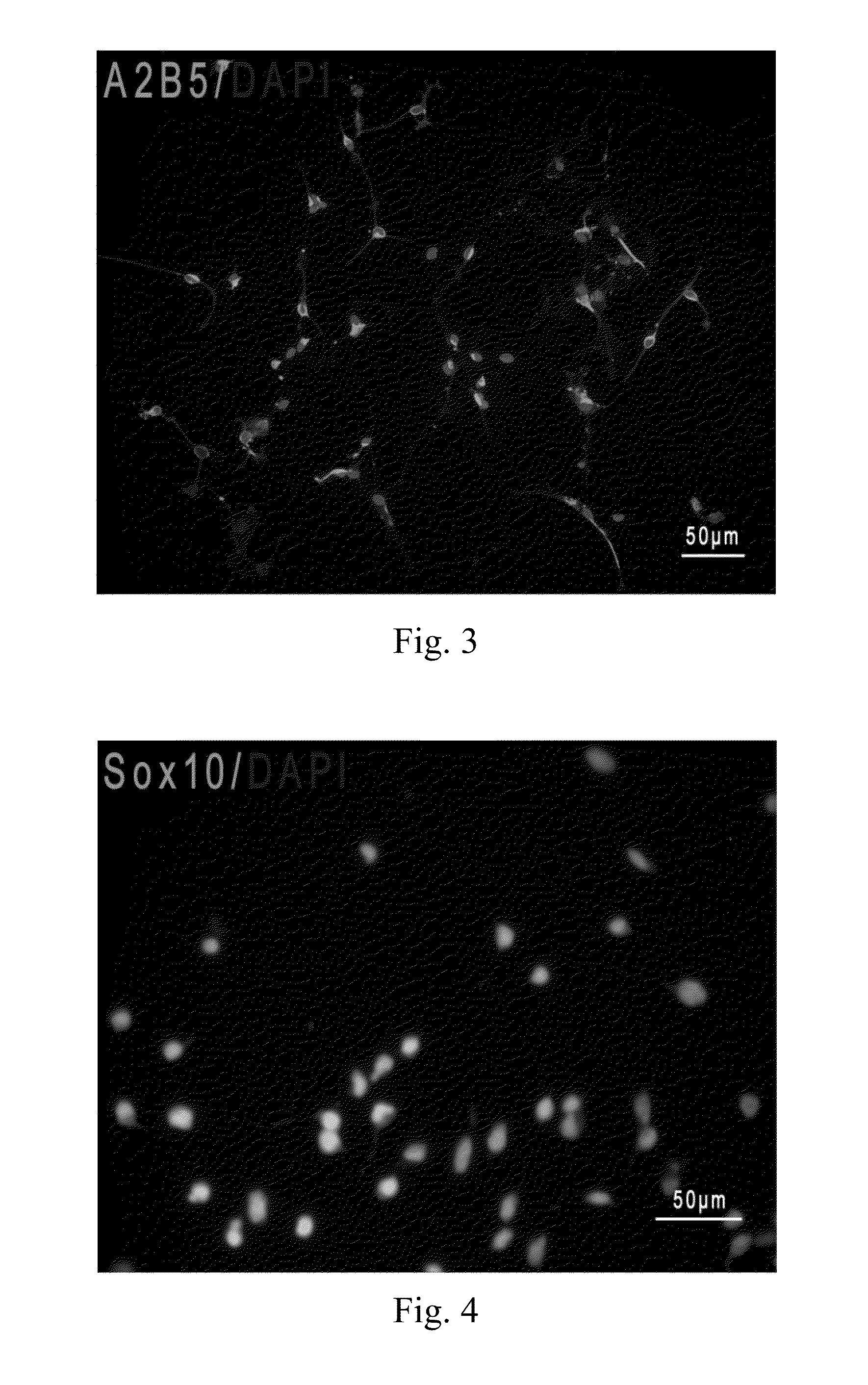 Differentiation and amplification method for inducing human neural
stem/progenitor cells to differentiate into oligodendrocyte progenitor cells and
application thereof