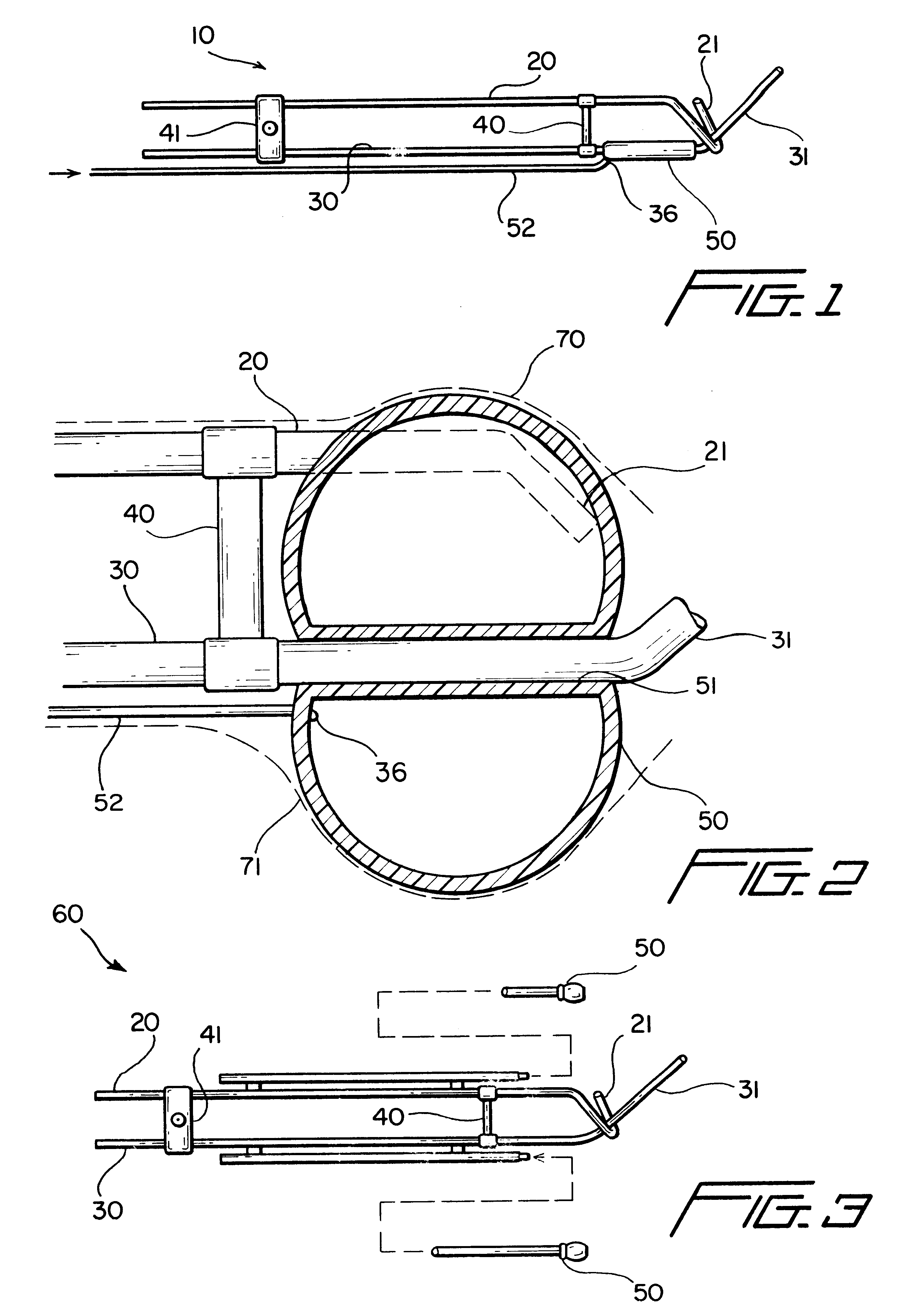 Cervical applicator for high dose radiation brachytherapy