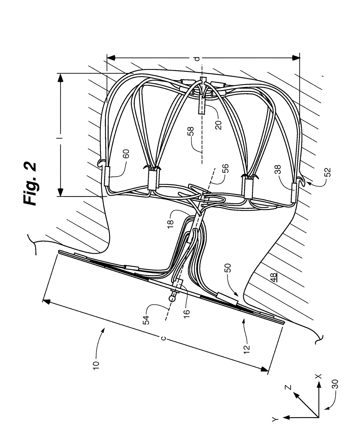 Left atrial appendage occlusion device