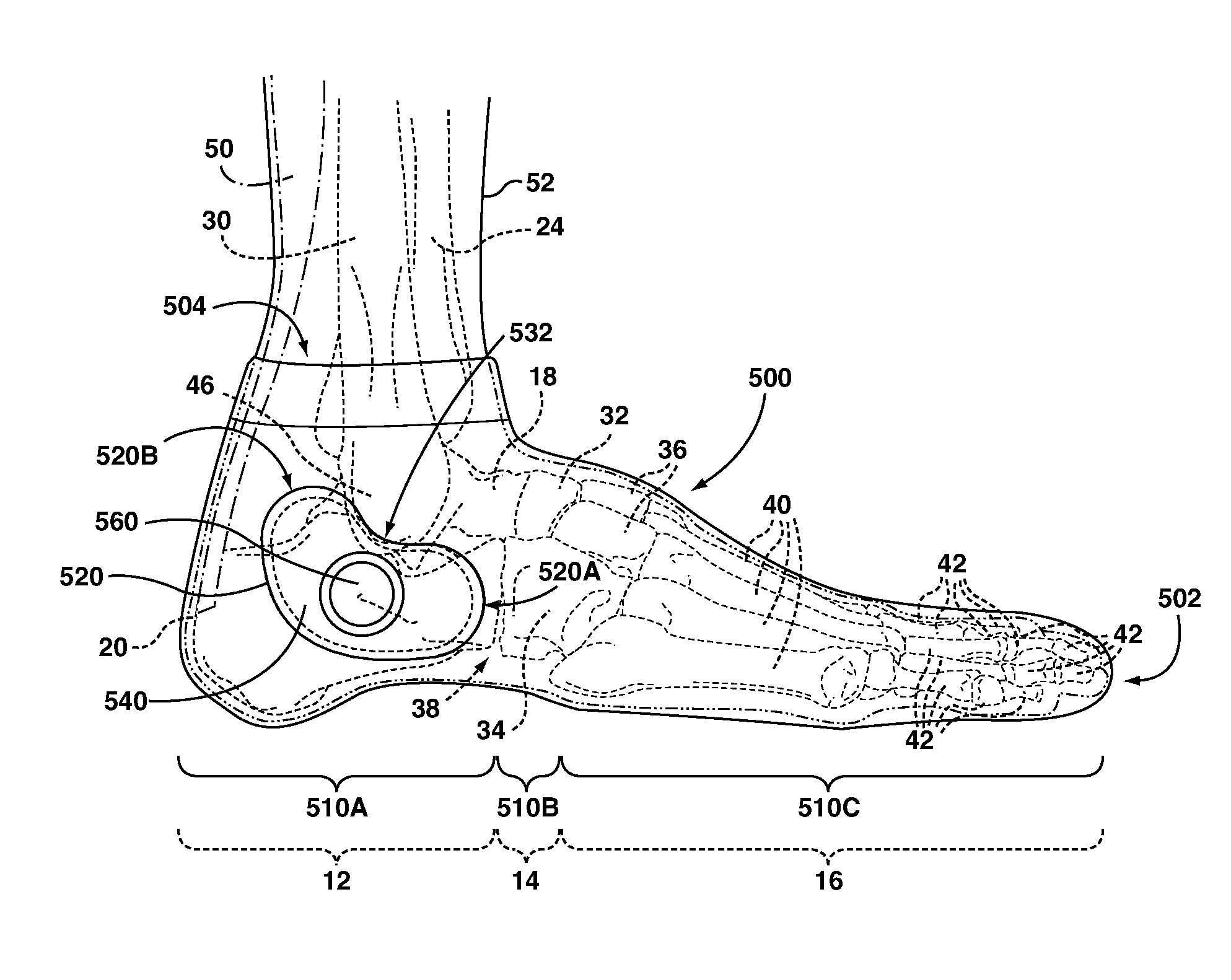 Foot stabilizer socks and stabilizer pads therefor