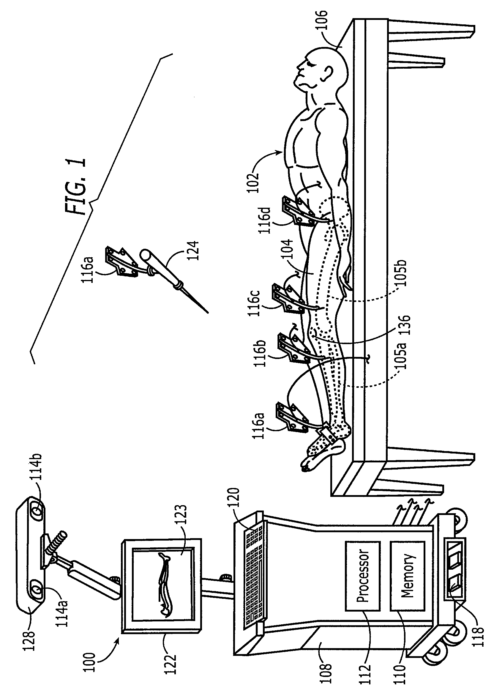 Method and apparatus for positioning a bone prosthesis using a localization system