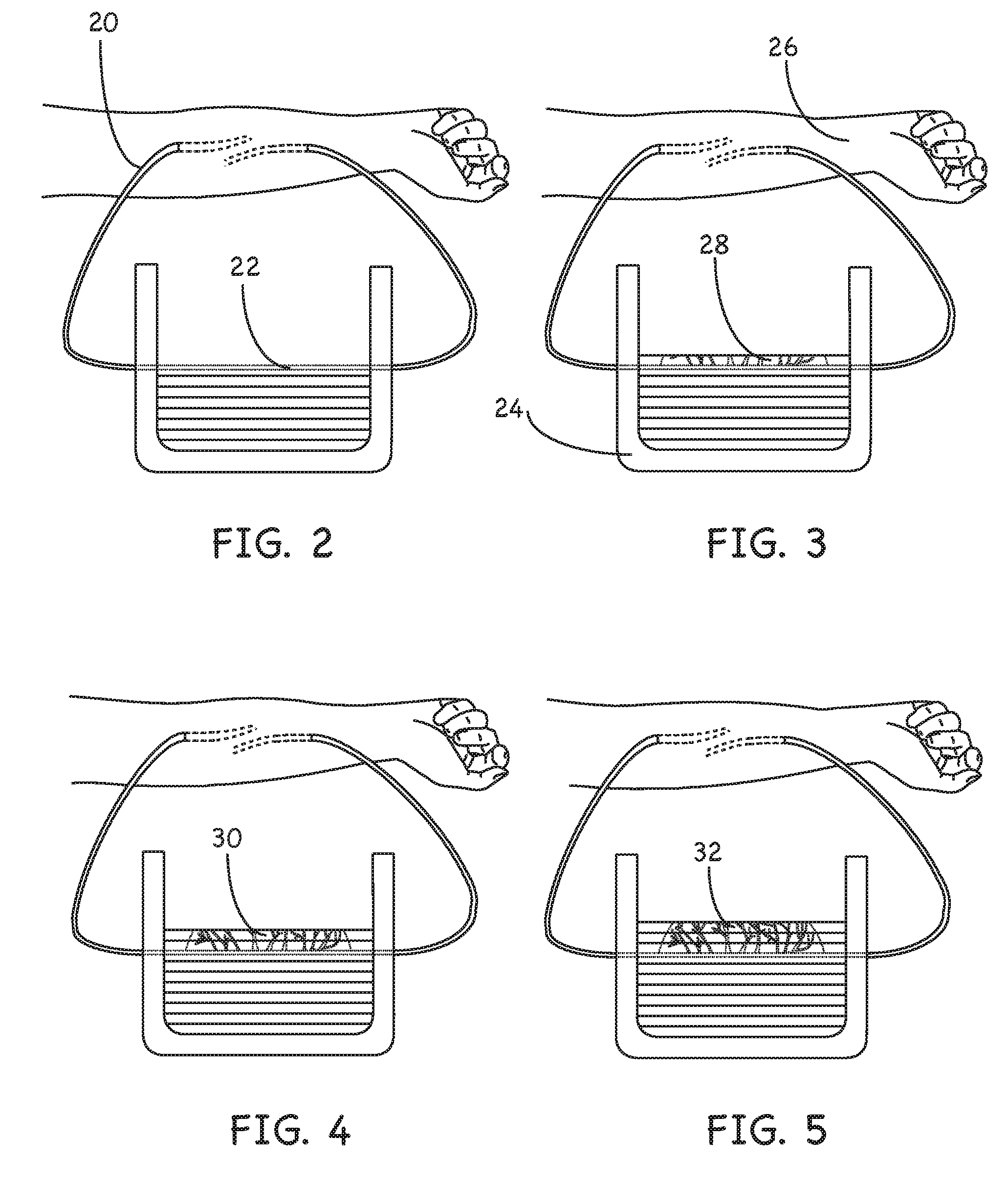 Method and Device for Perfusing Tissue by ExVivo Attachment to a Living Organism