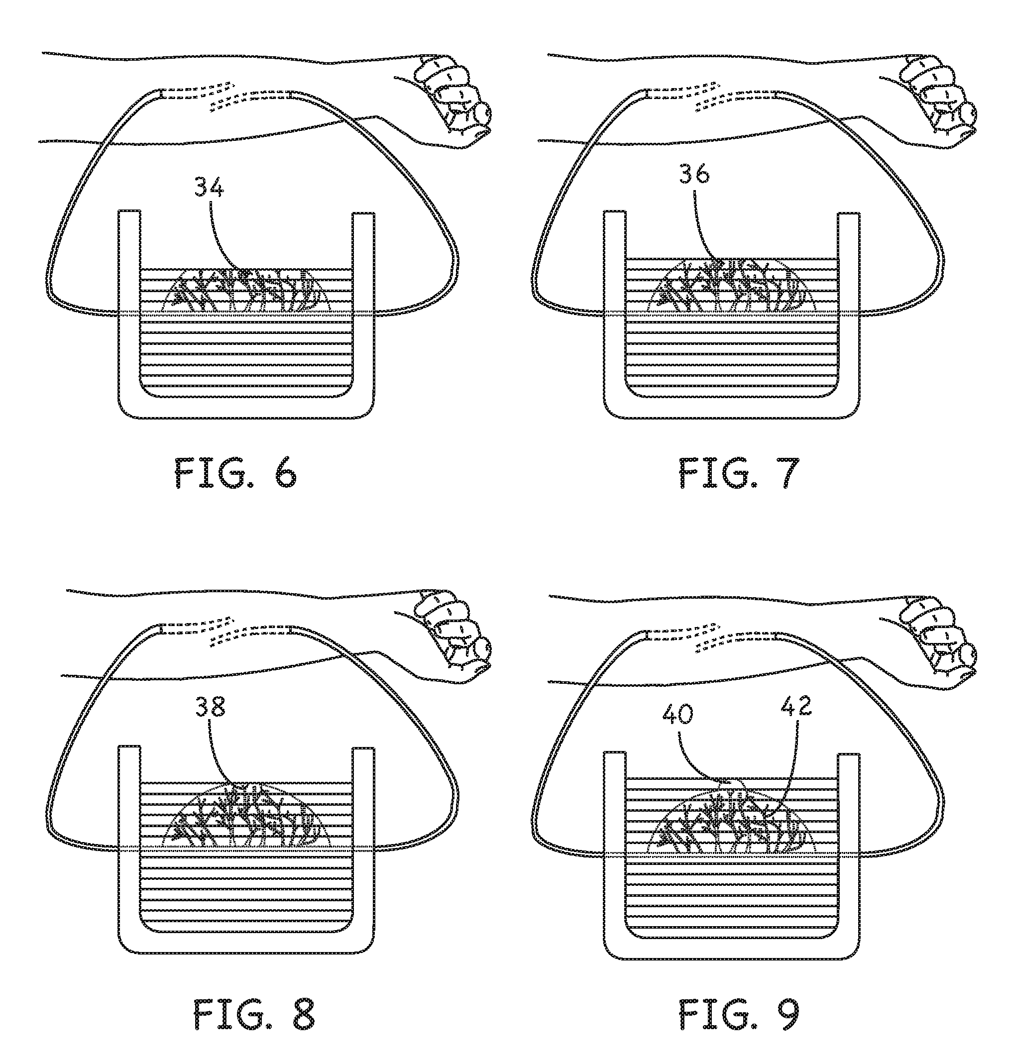 Method and Device for Perfusing Tissue by ExVivo Attachment to a Living Organism