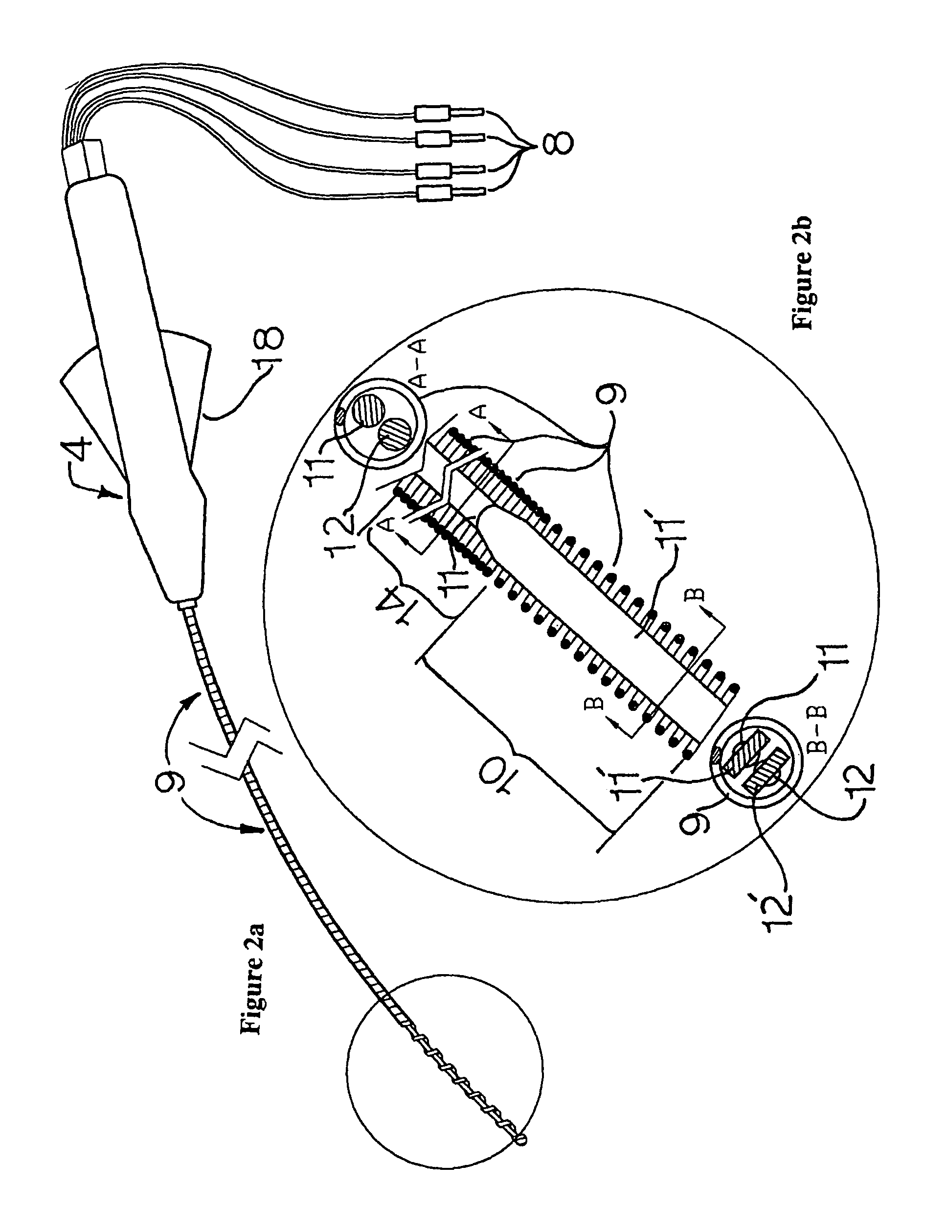 Electrophysiology/ablation catheter and remote actuator therefor