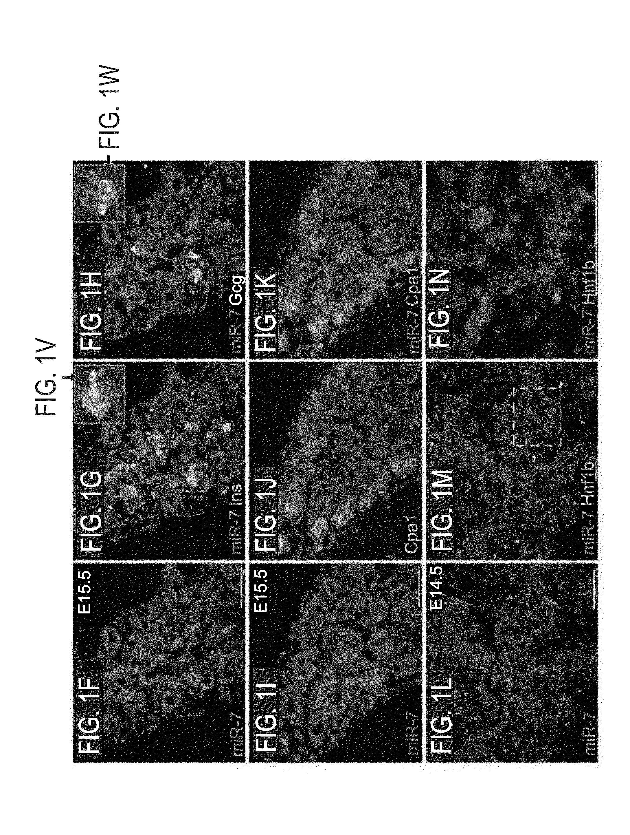 DOWNREGULATION OF miR-7 FOR PROMOTION OF BETA CELL DIFFERENTIATION AND INSULIN PRODUCTION