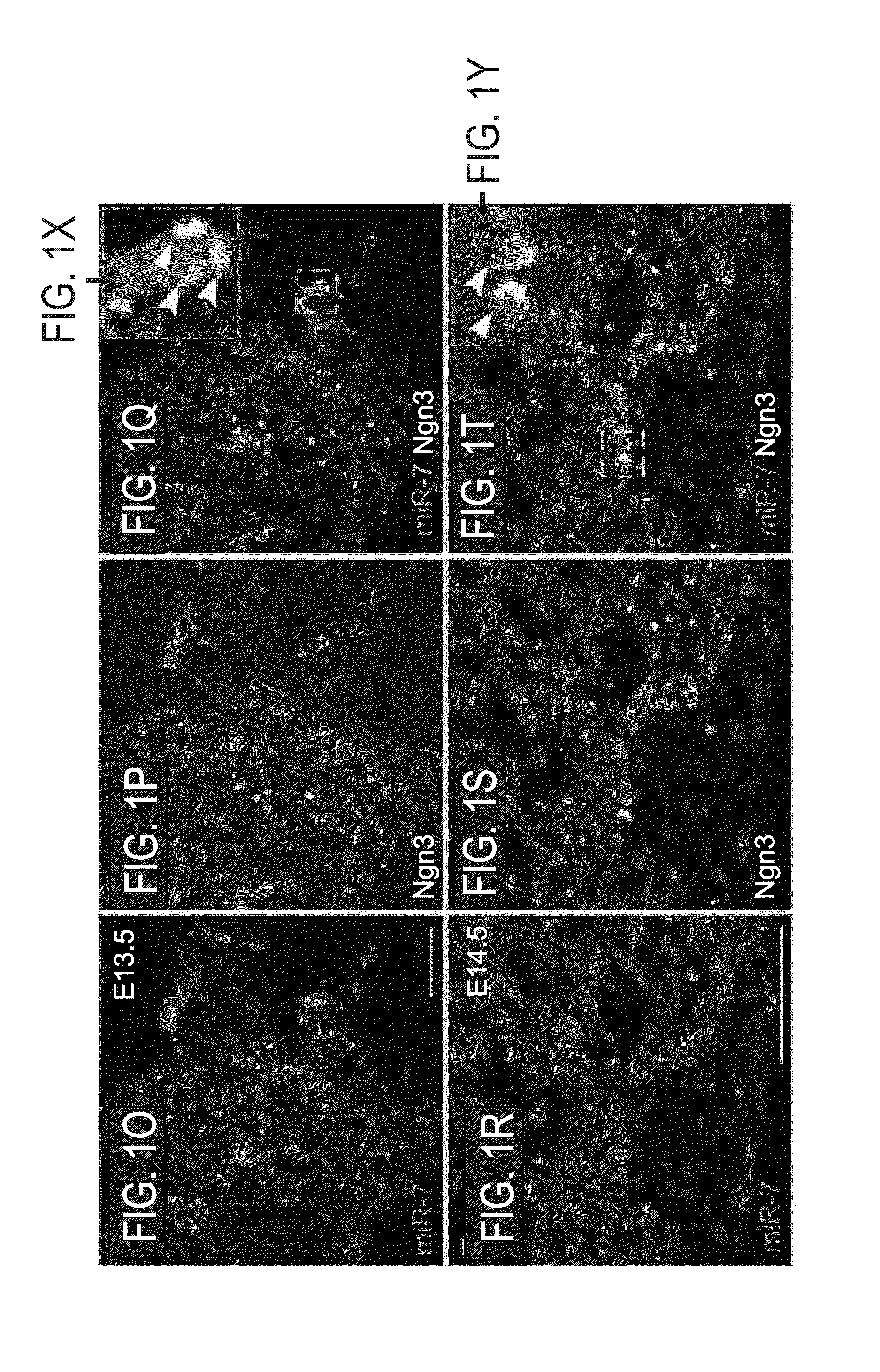 DOWNREGULATION OF miR-7 FOR PROMOTION OF BETA CELL DIFFERENTIATION AND INSULIN PRODUCTION