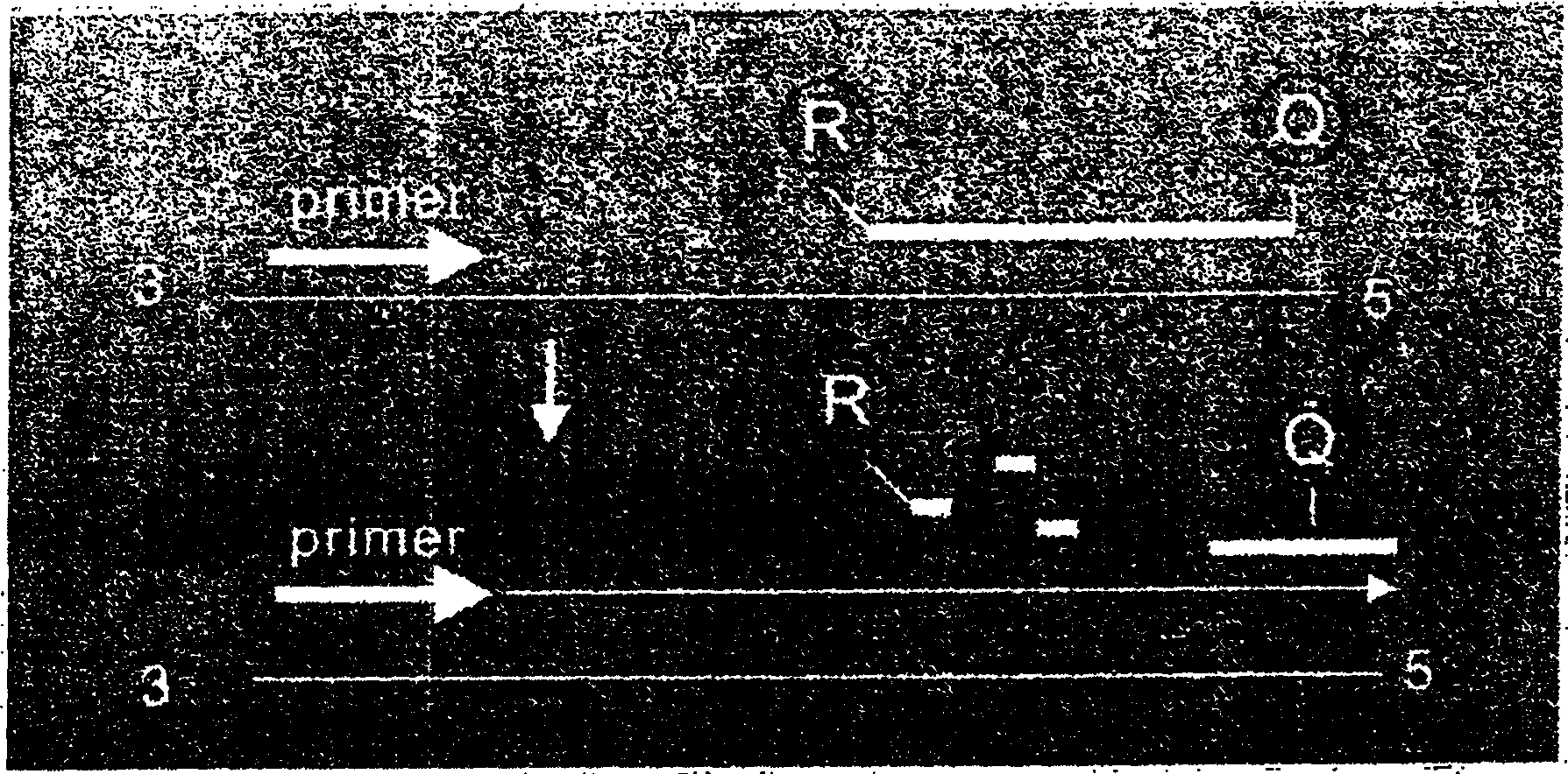 Gene detection reagent kit for SARS virus and its detection method