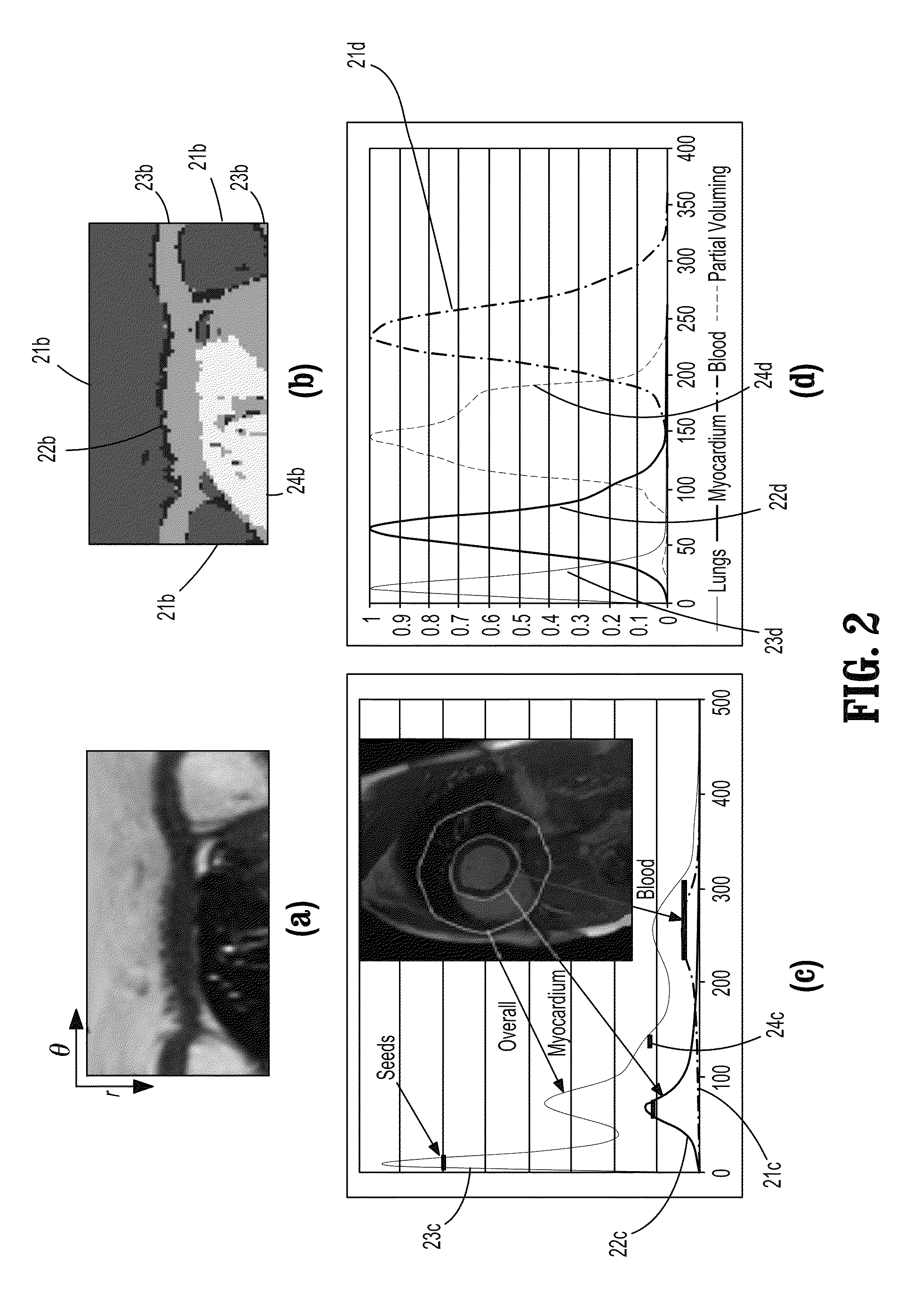 System and method for cardiac segmentation in MR-cine data using inverse consistent non-rigid registration