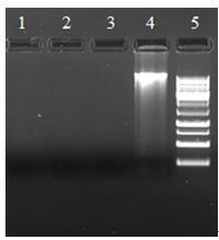 Extracting micro viper gene and specific detection method thereof