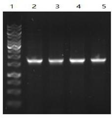 Extracting micro viper gene and specific detection method thereof