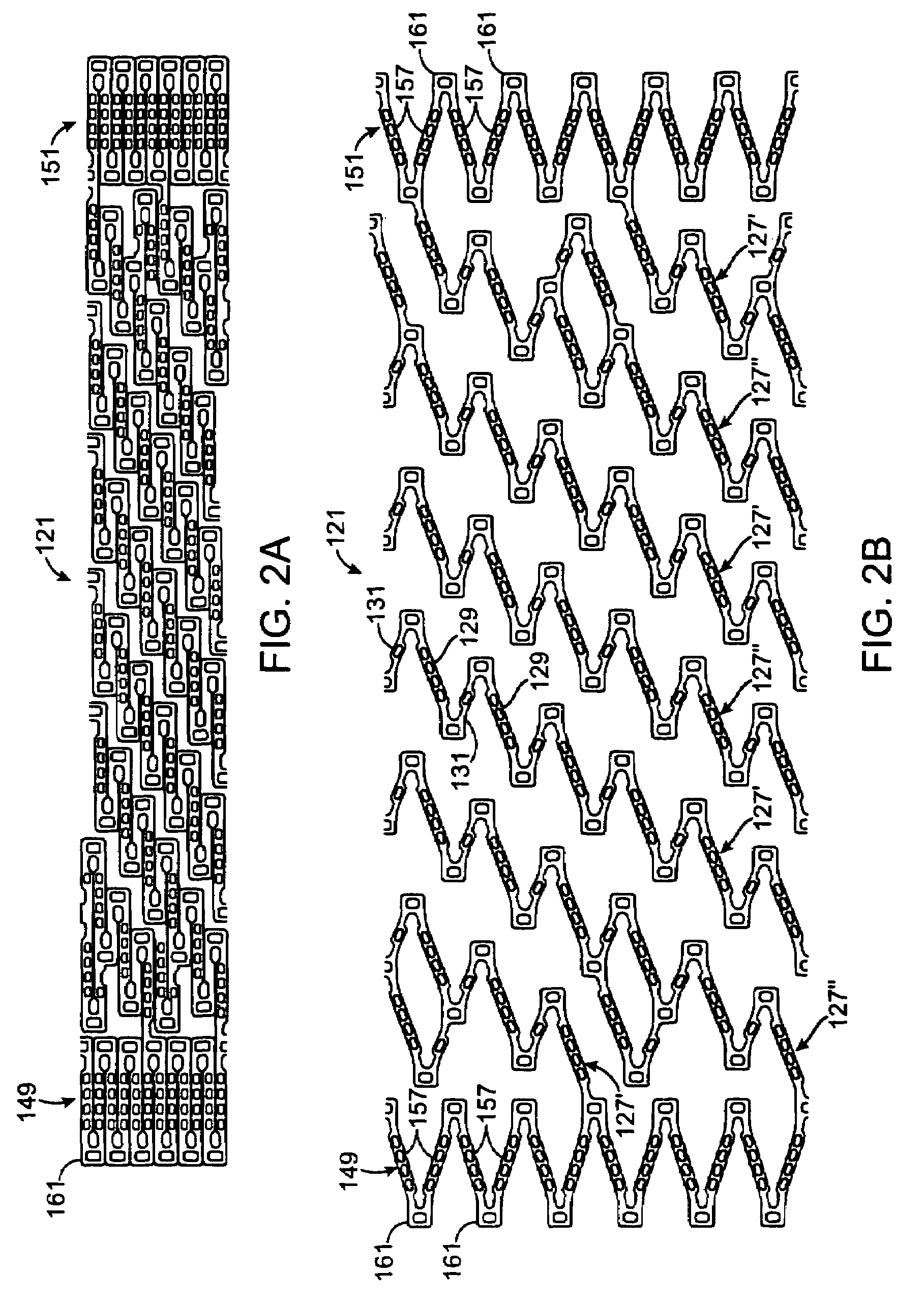 Stent with flexible hinges