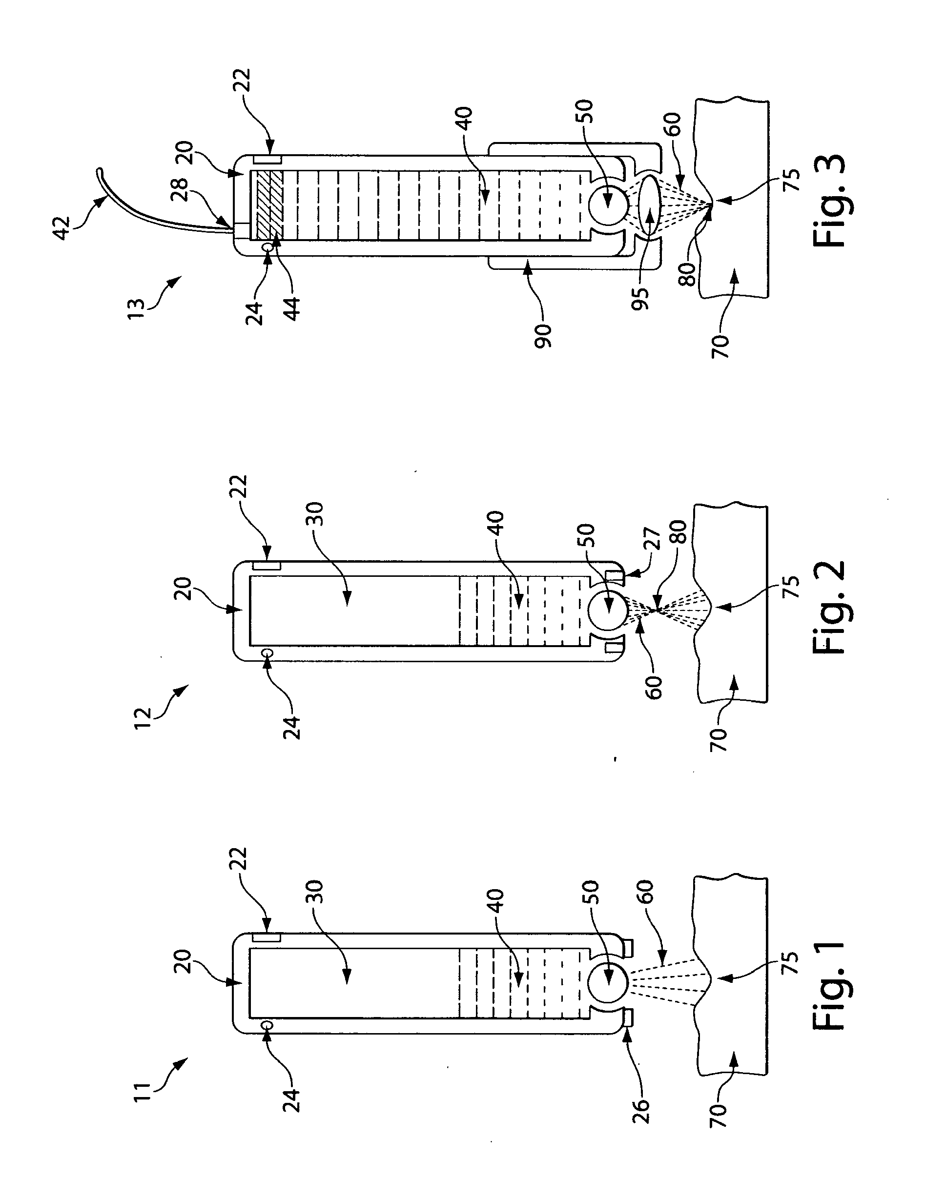 Portable Semiconductor Diode Laser for Medical Treatment