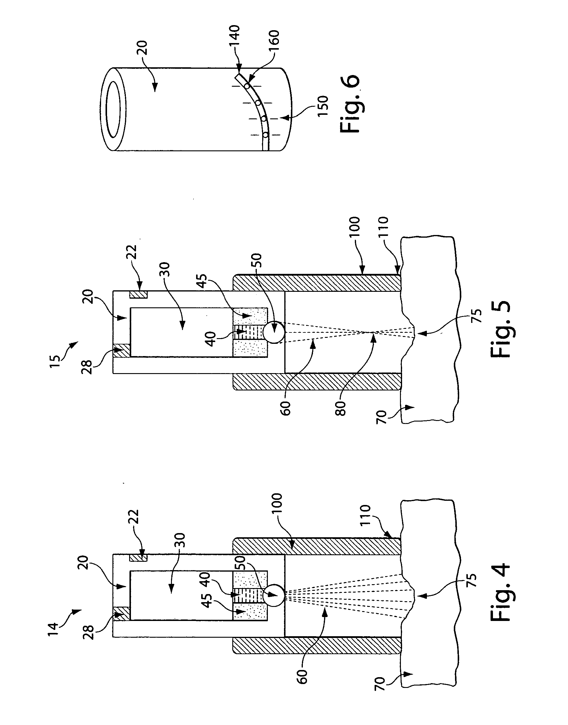 Portable Semiconductor Diode Laser for Medical Treatment